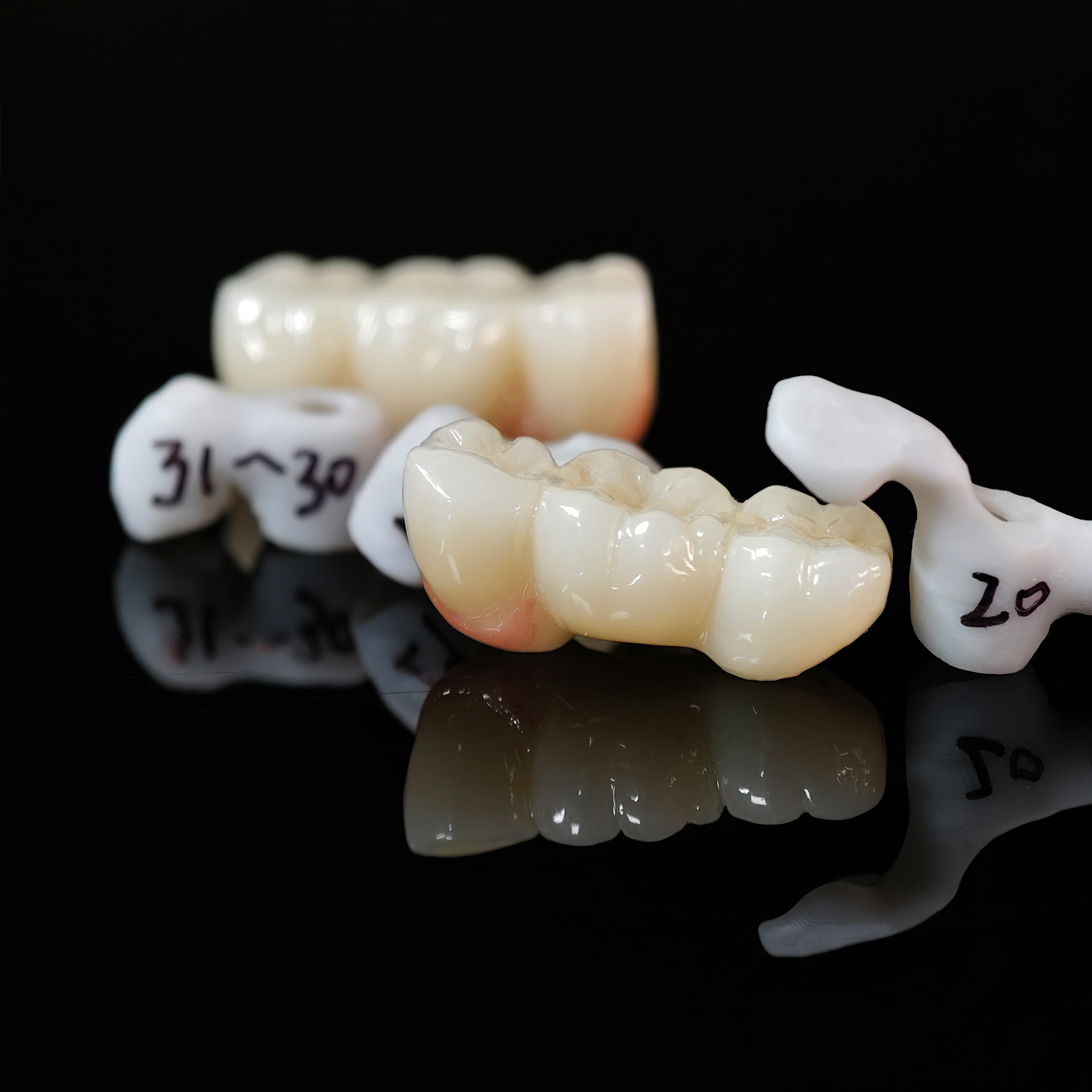 Zirconia implant bridge Screwmentable de