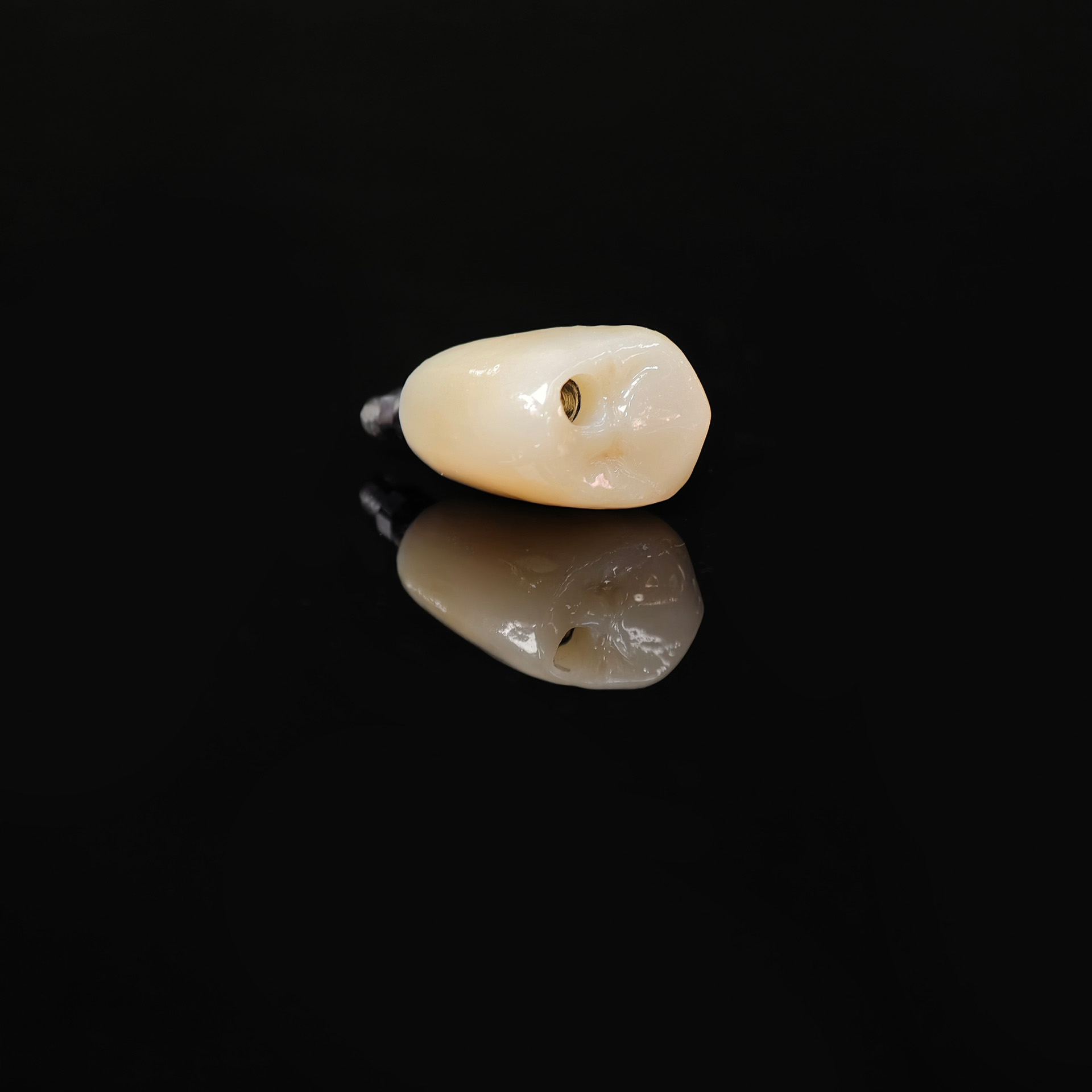 Zirconia crown with screw retained