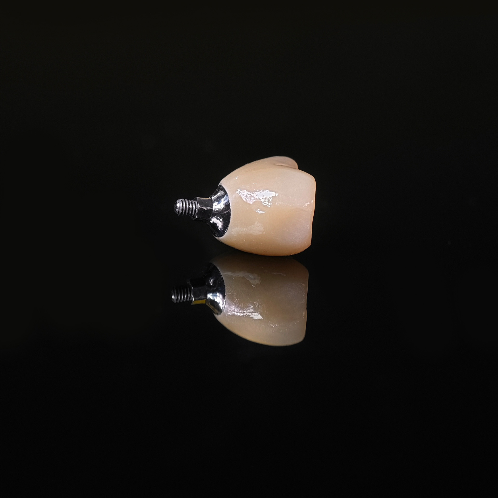 Zirconia crown with screw retained