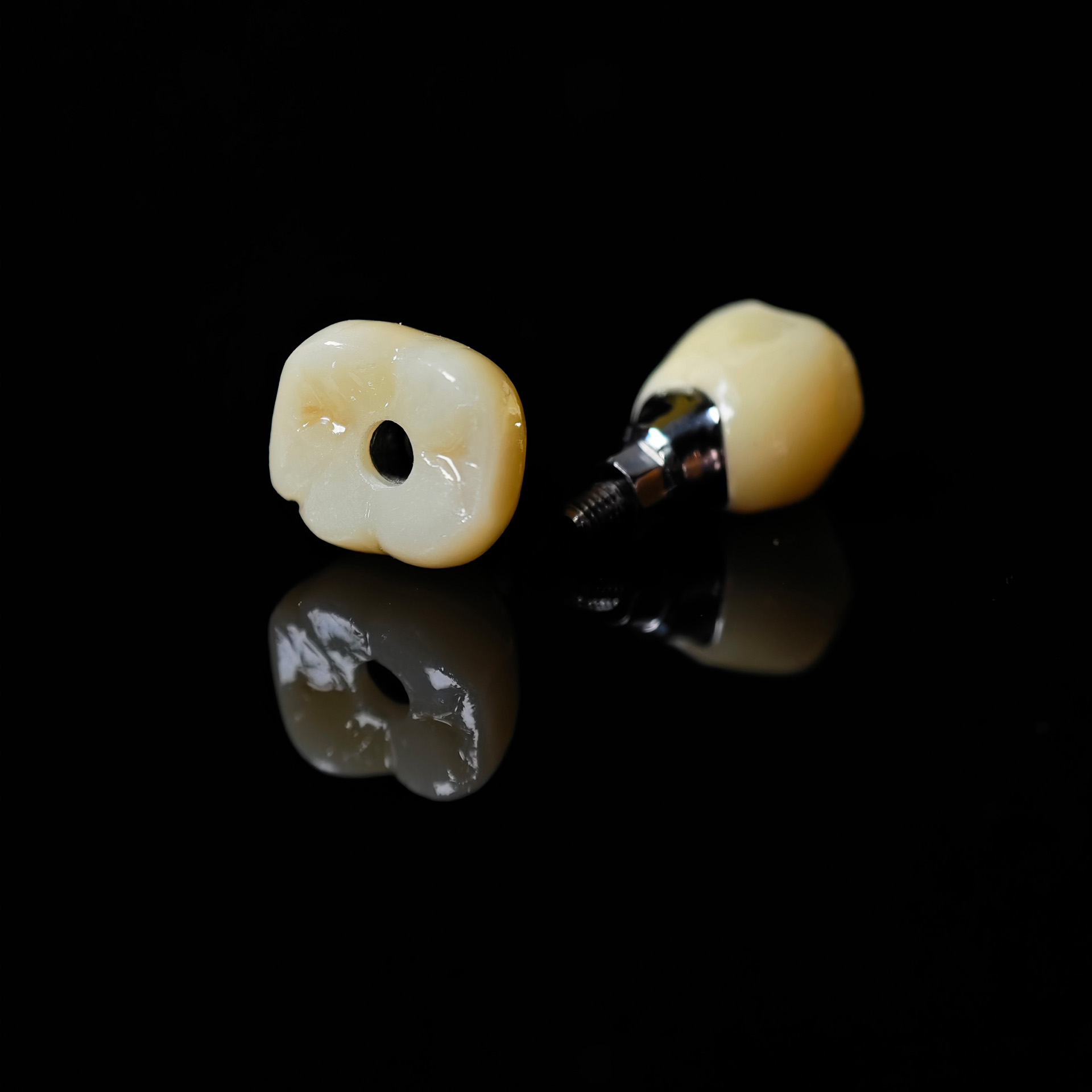 Zirconia crowns with screw retained