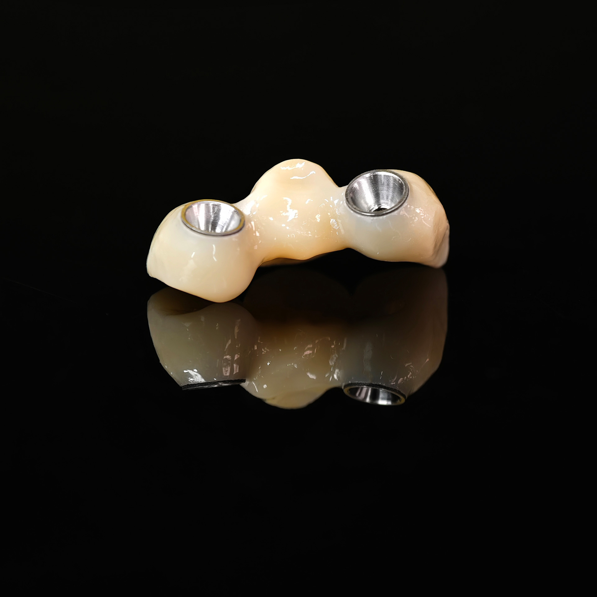 Zirconia bridge with Ti-base screw retai
