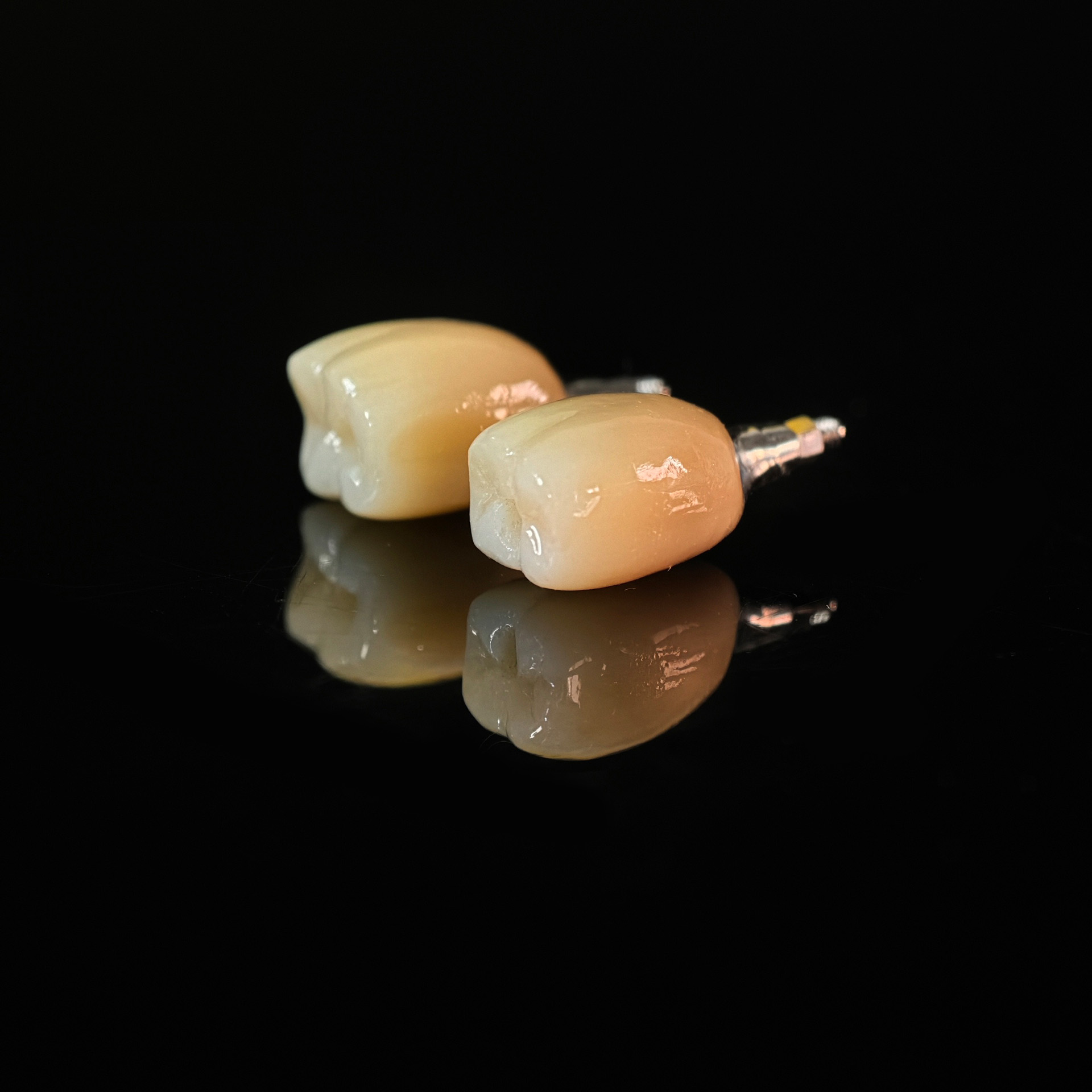 Zirconia crowns with screw retained