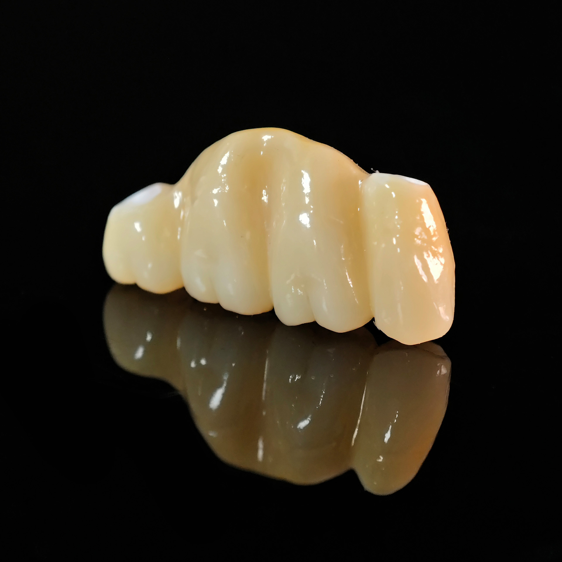 Zirconia implant bridge Screwmentable de