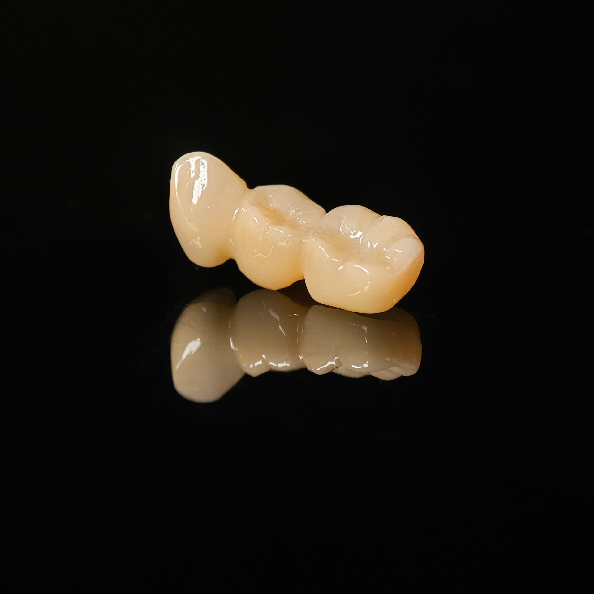 High - Strength Zirconia Bridg