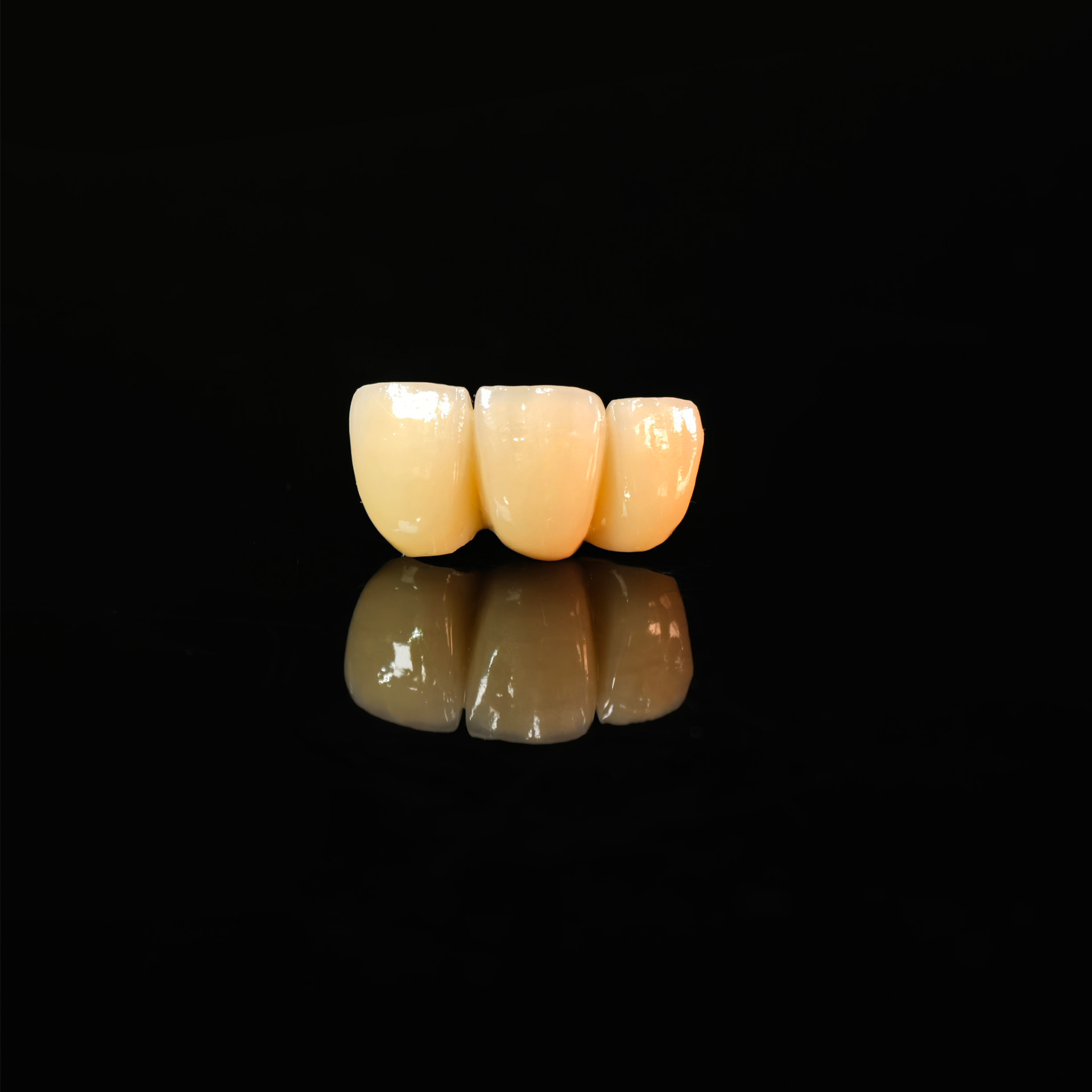 High - Strength Zirconia Bridg