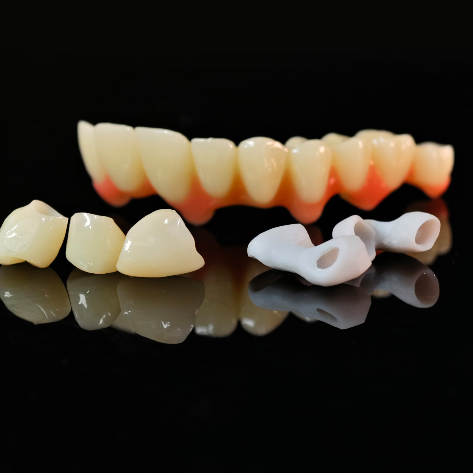 custom abutment and pmma bridge and crow