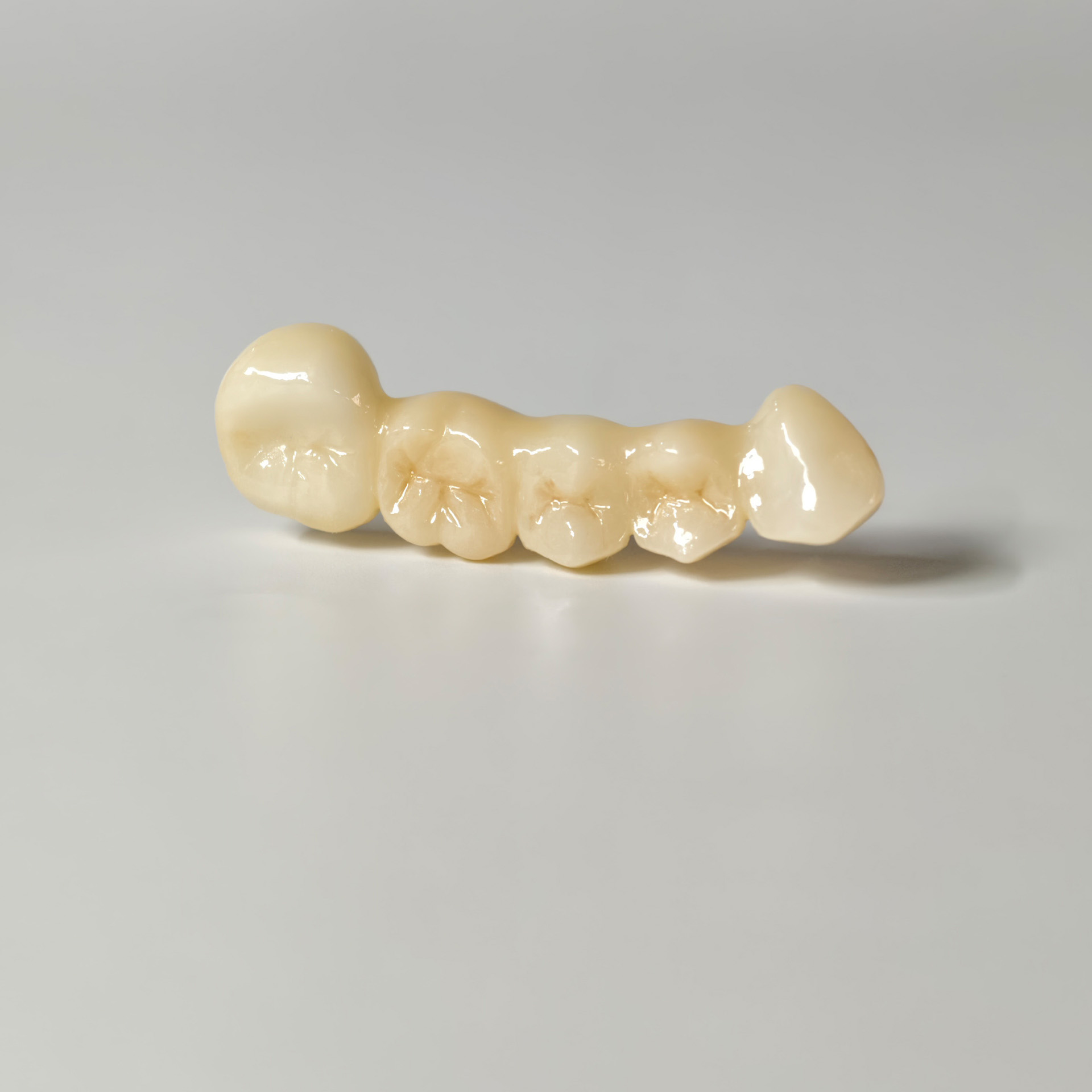 High - Strength Zirconia Bridge
