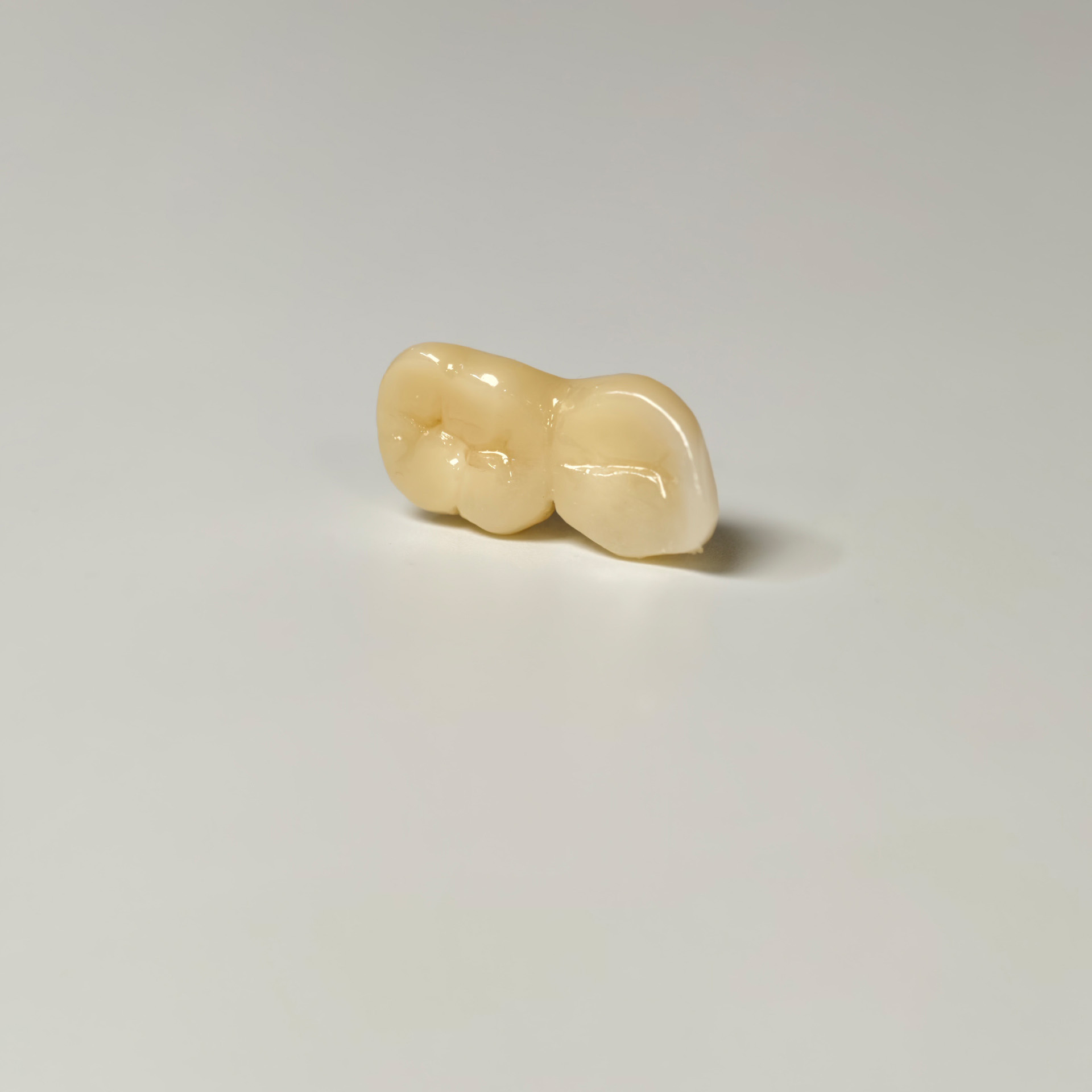 High - Strength Zirconia Bridge