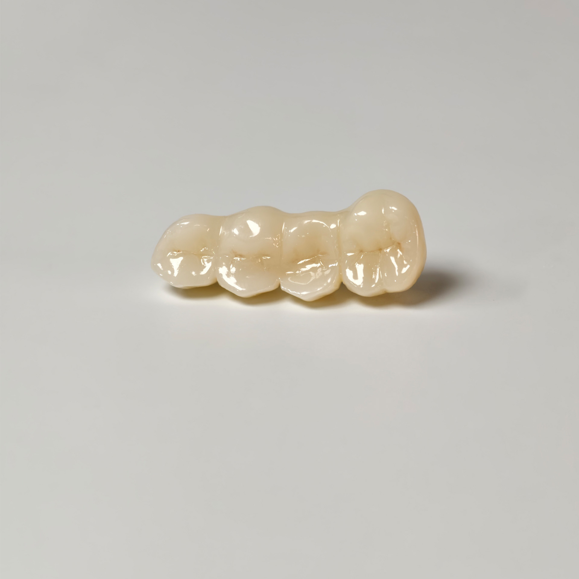 High - Strength Zirconia Bridge