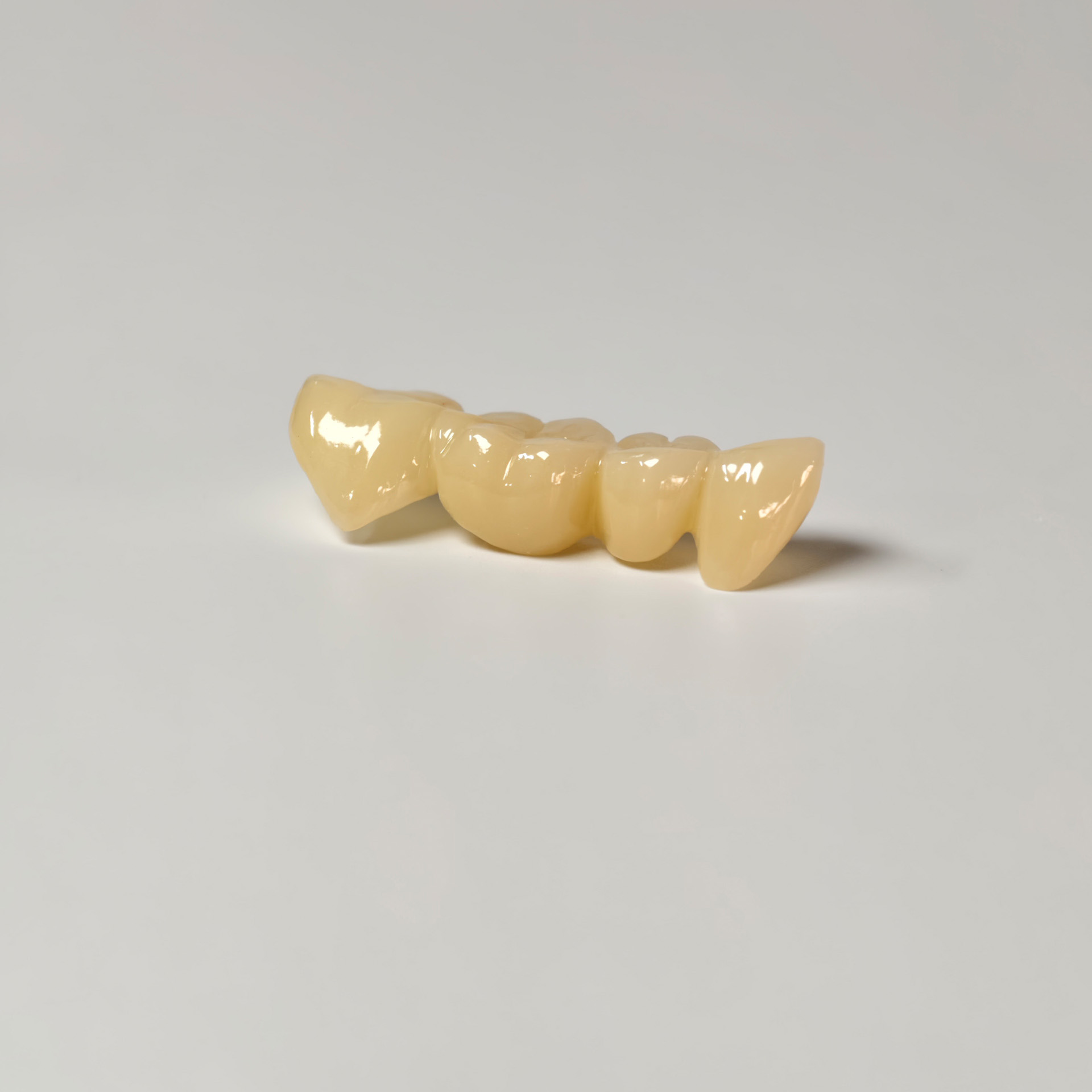 High - Strength Zirconia Bridge