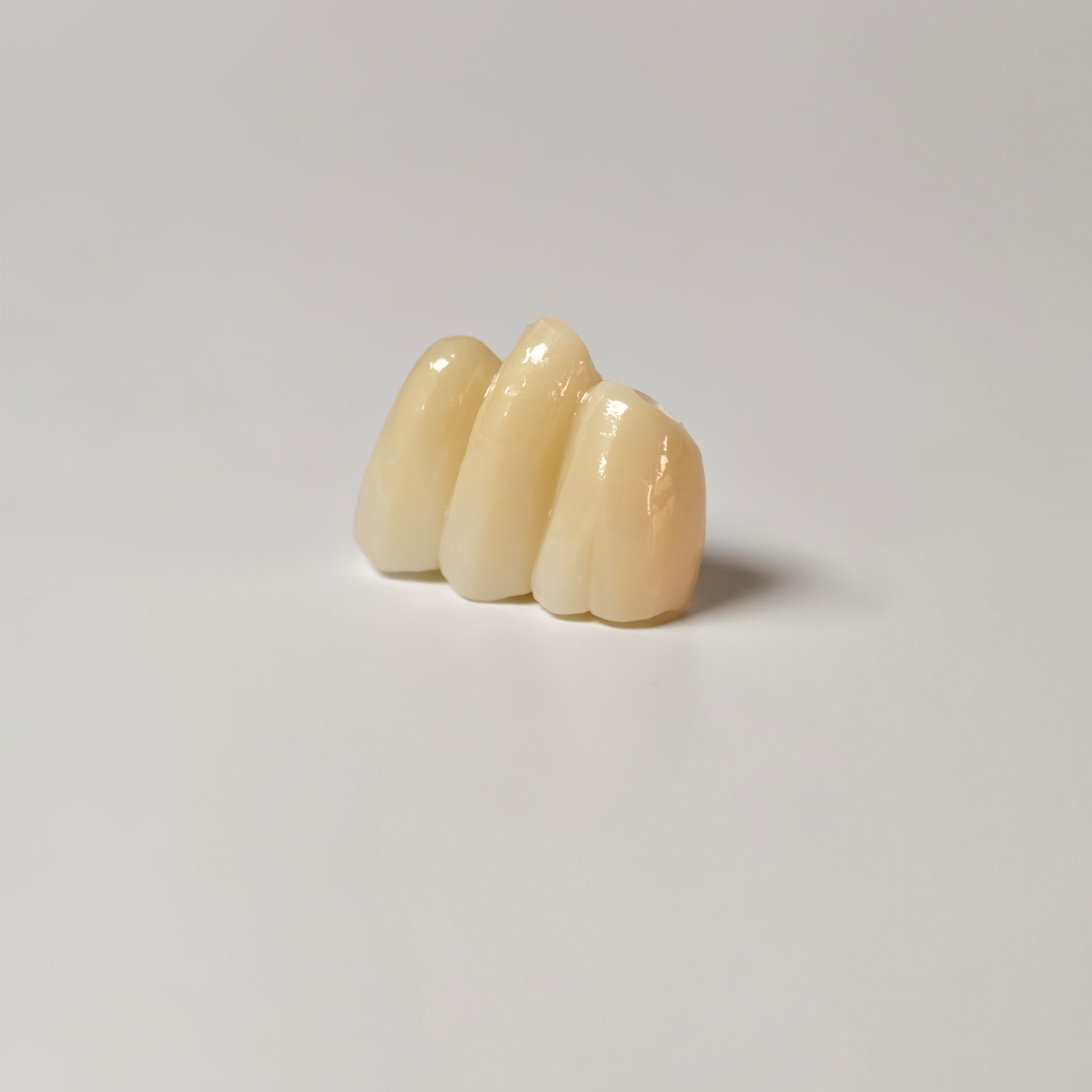 High - Strength Zirconia Bridge