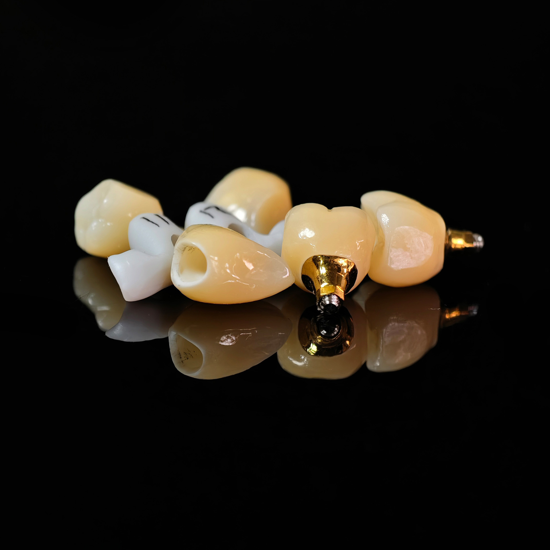 Zirconia crowns with gold-plated abutmen