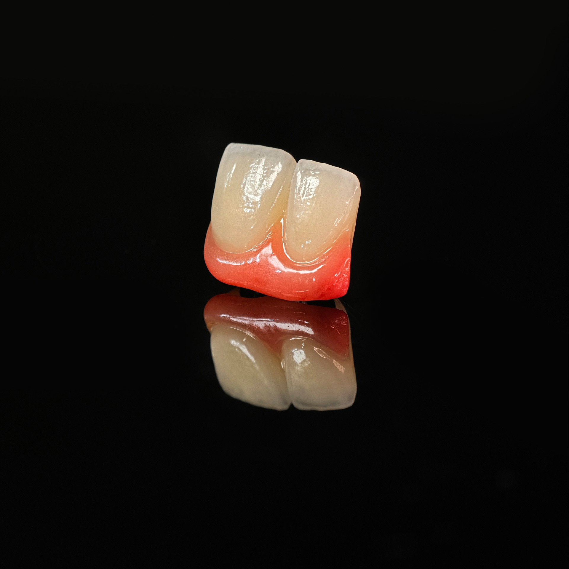 Zirconia bridge with ti-base bautment