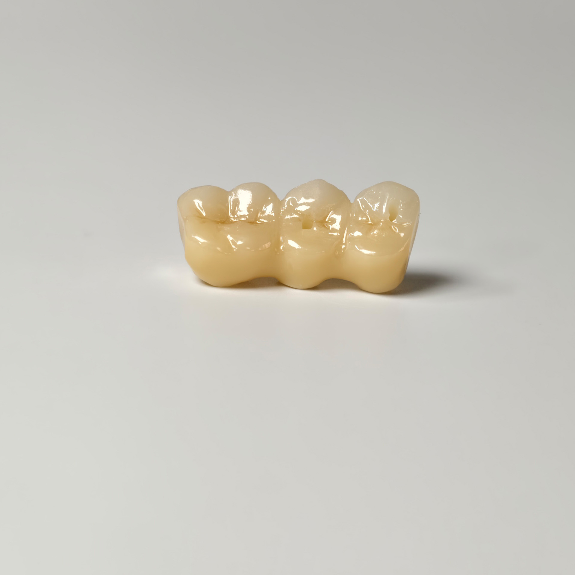 Zirconia implant bridge Screwmentable de