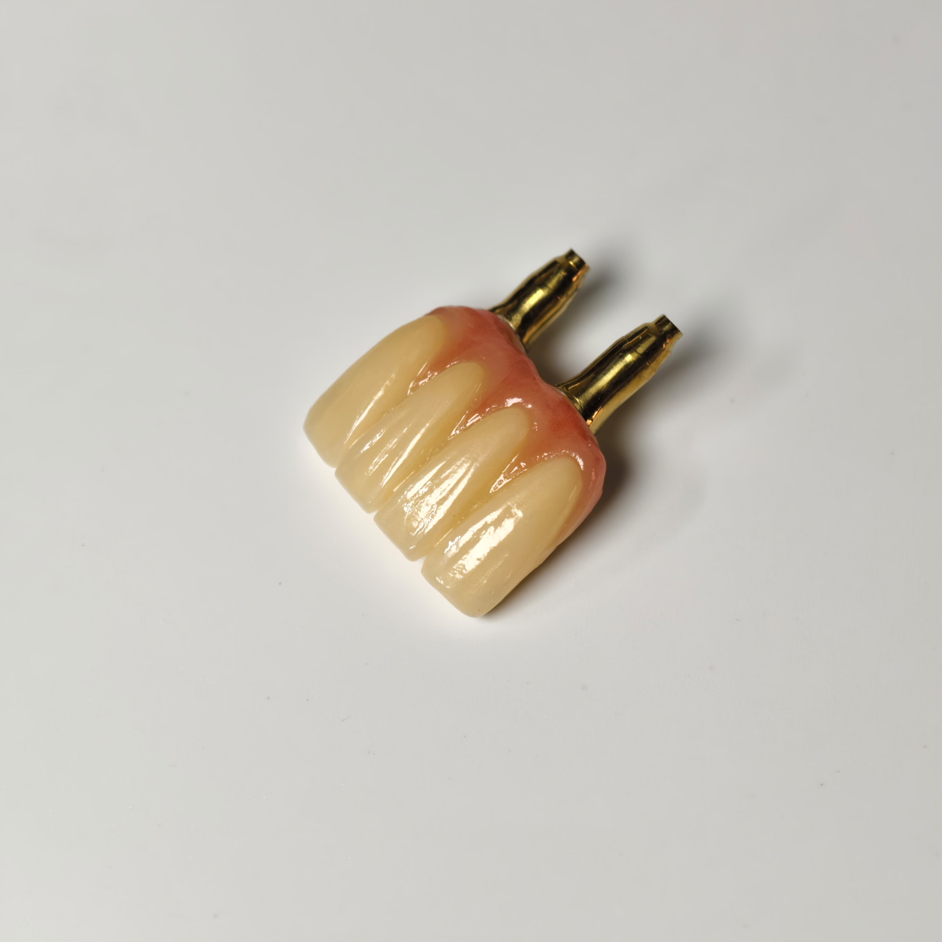 Zirconia crown with gold-plated abutment