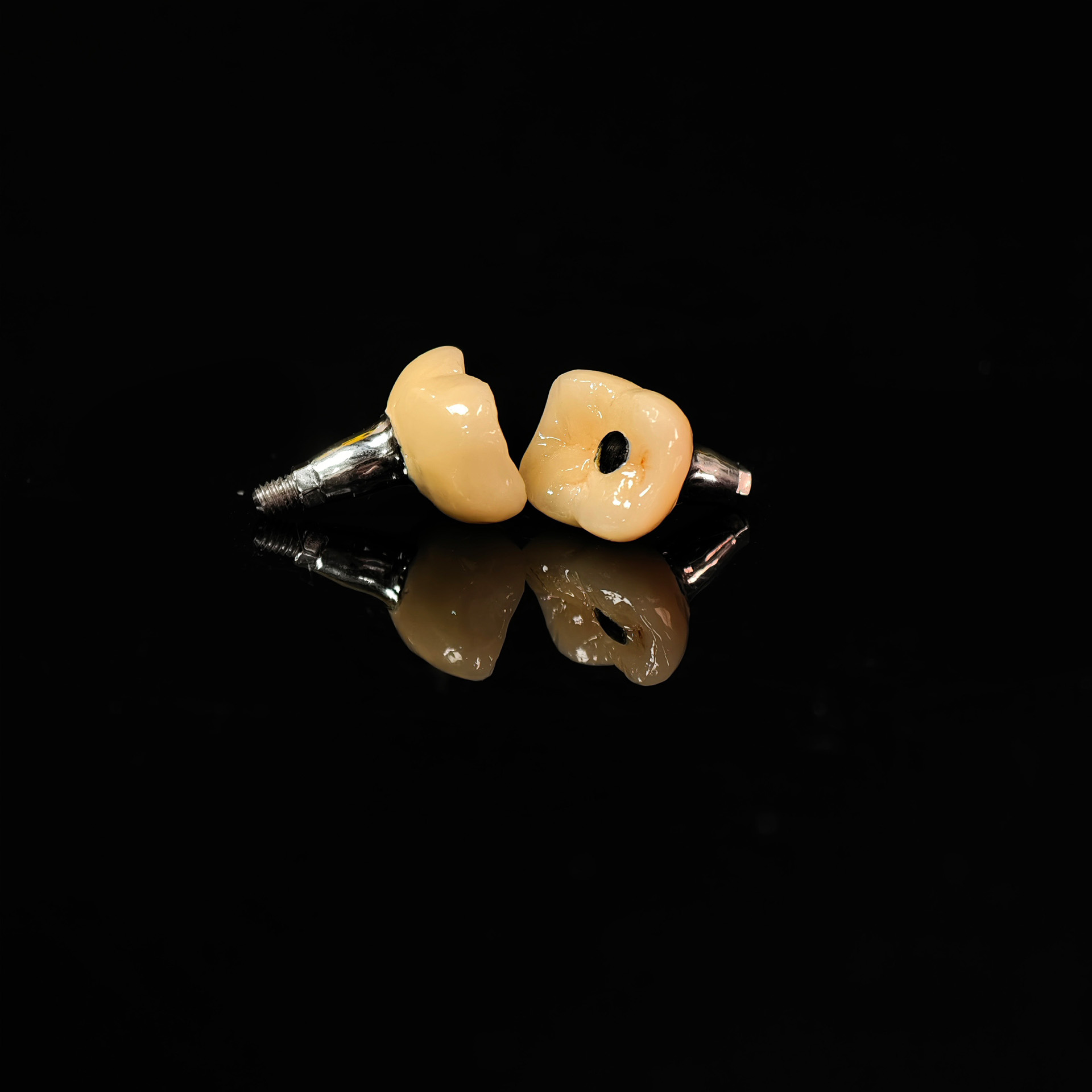 Implant-supported PFM single crowns