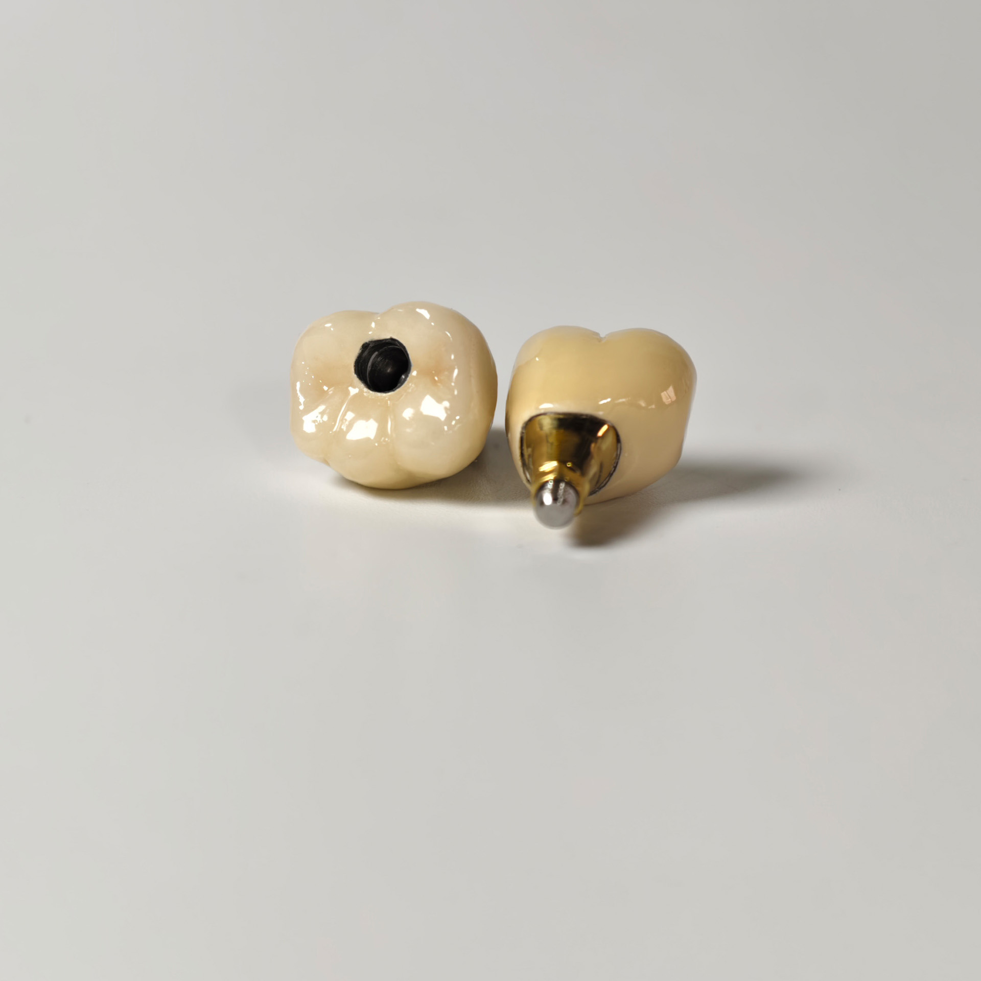 Implant-supported PFM single crowns