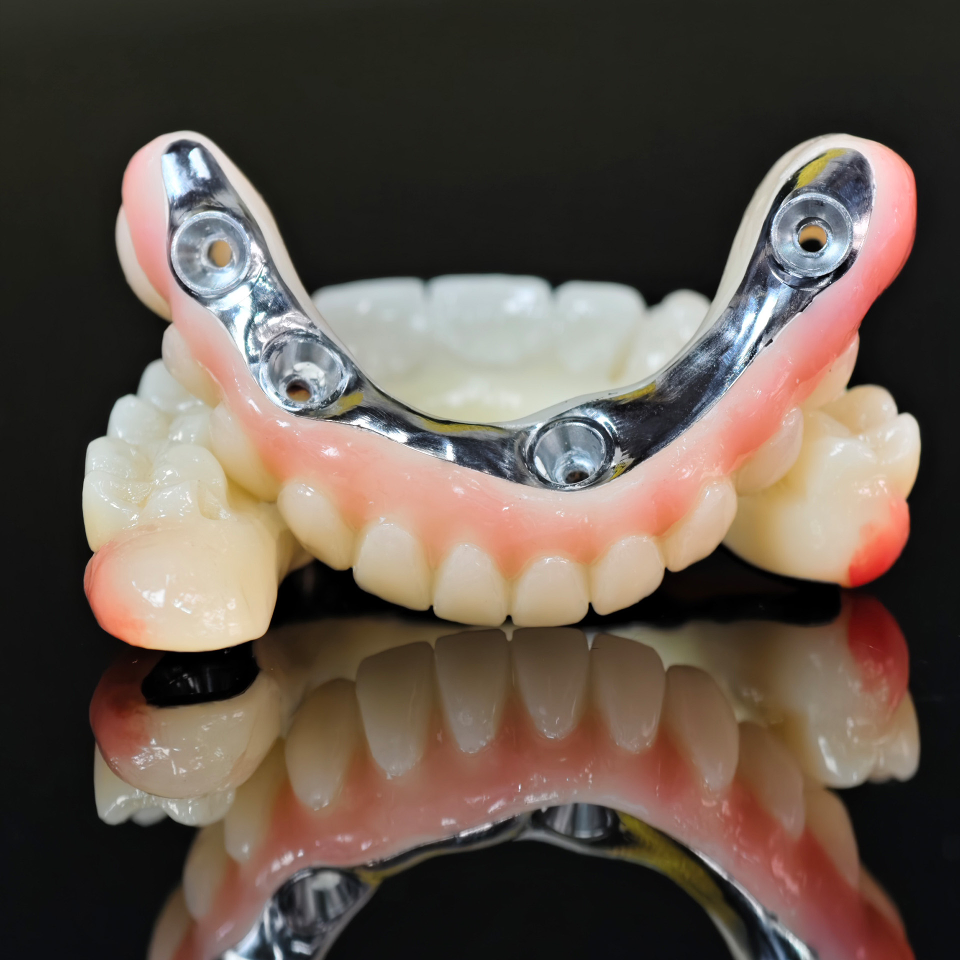 Ti-bar titanium nitride metal frame with