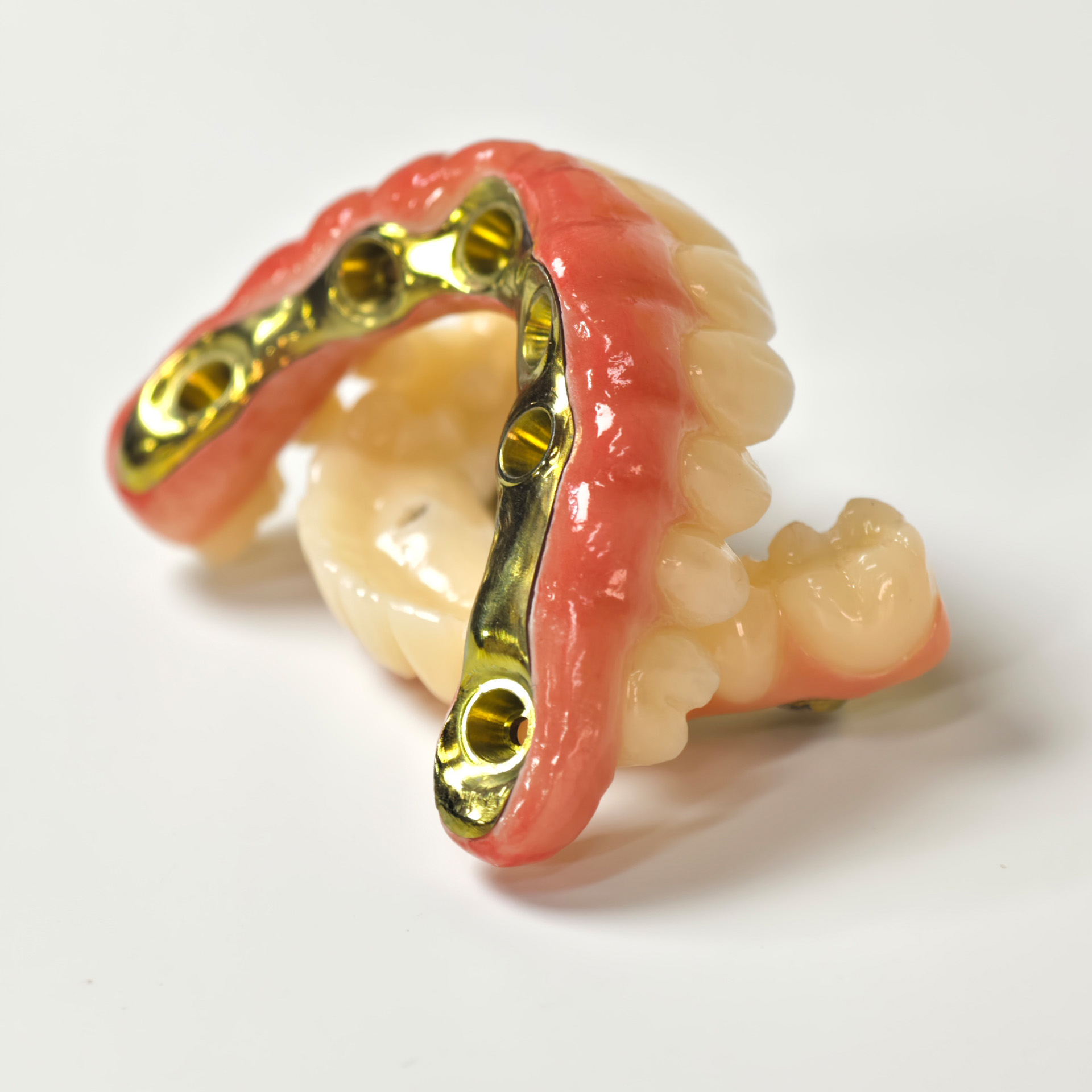 Ti-bar titanium nitride metal frame with