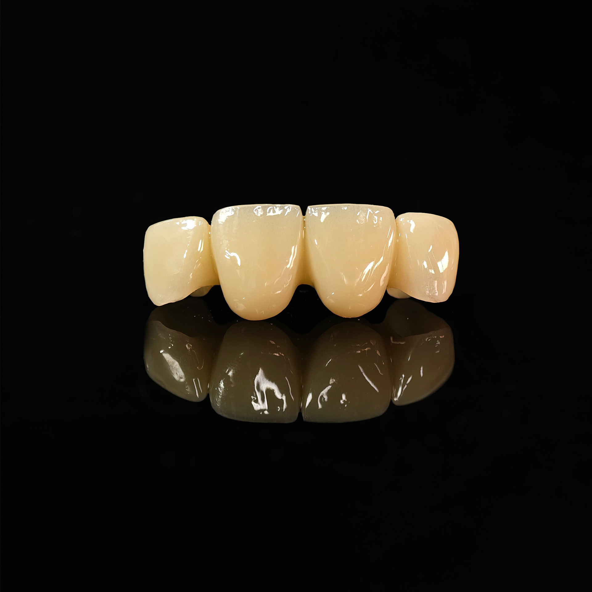 Pmma bridge with cement retained