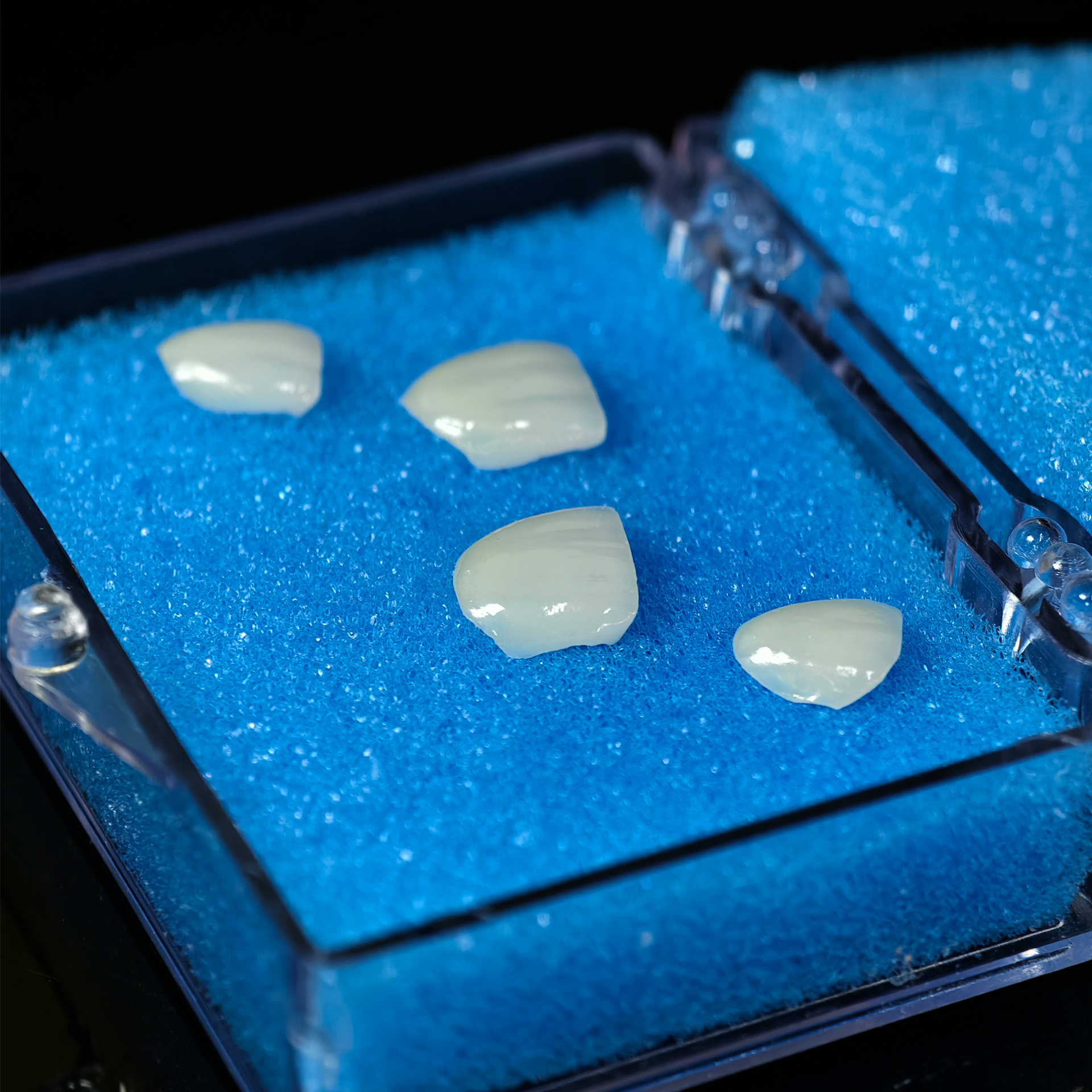 Ultra-thin emax veneer. High transparenc