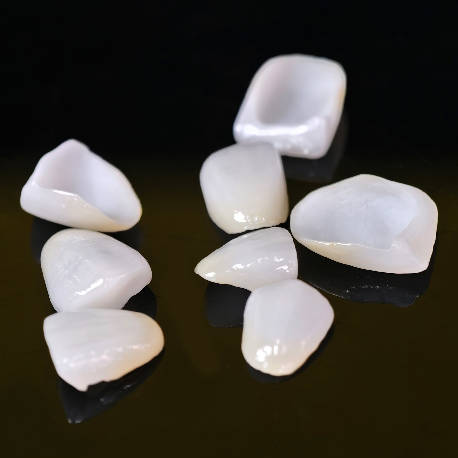 Ultra-thin emax veneer. High transparenc