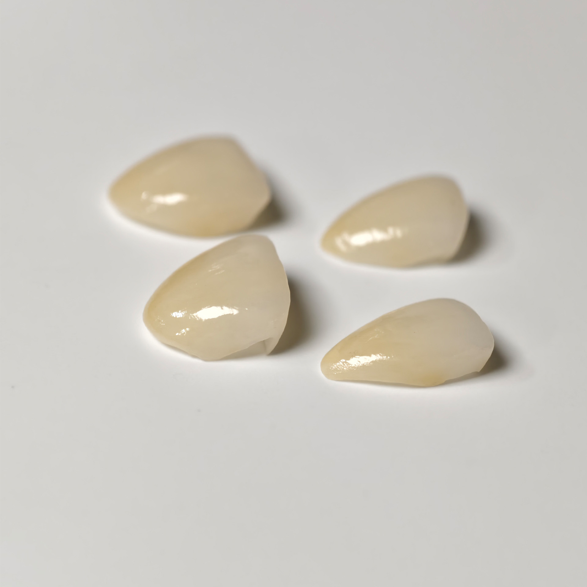 Ultra-thin emax veneer. High transparenc