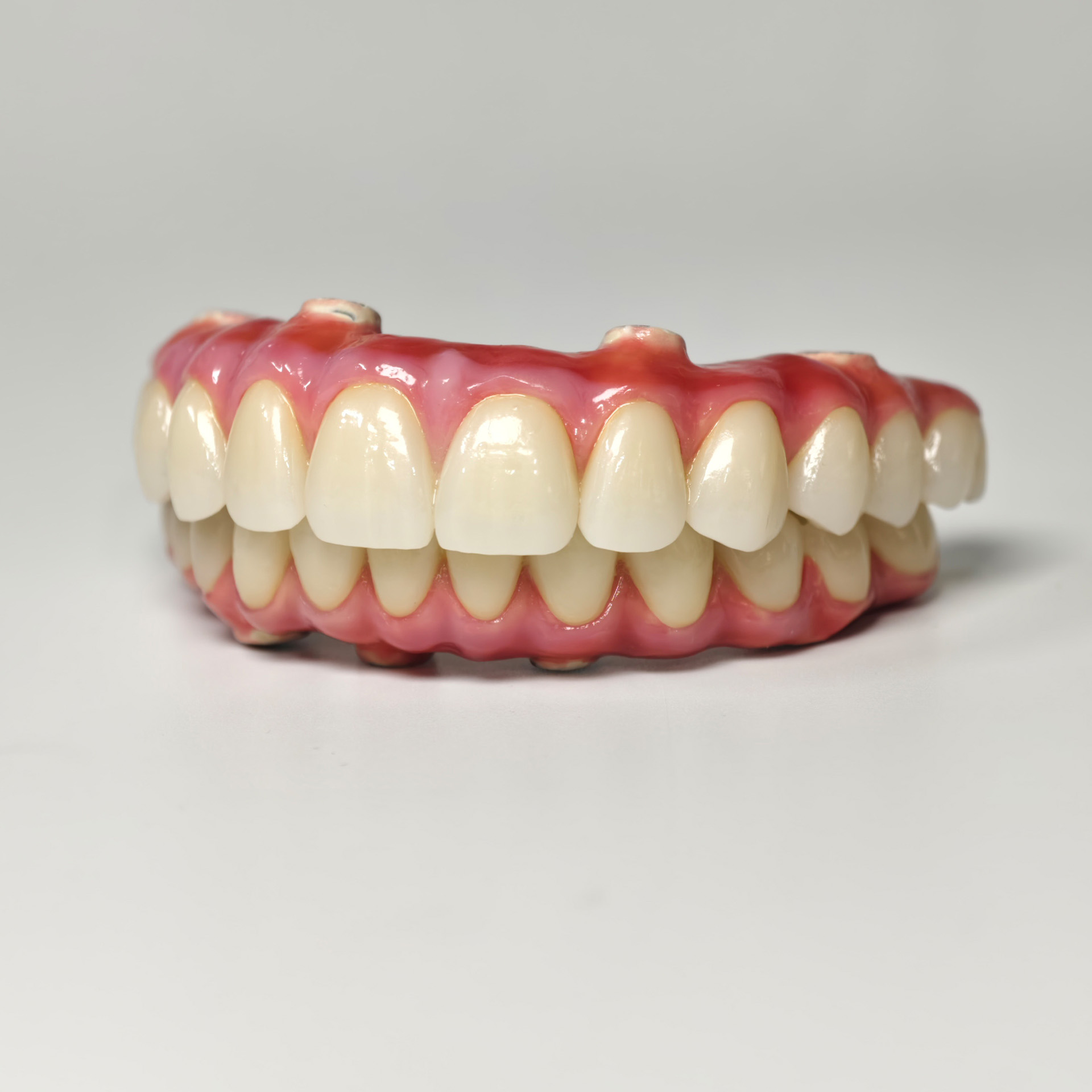 Zirconia-Enamel Hybrid Malo Bridge