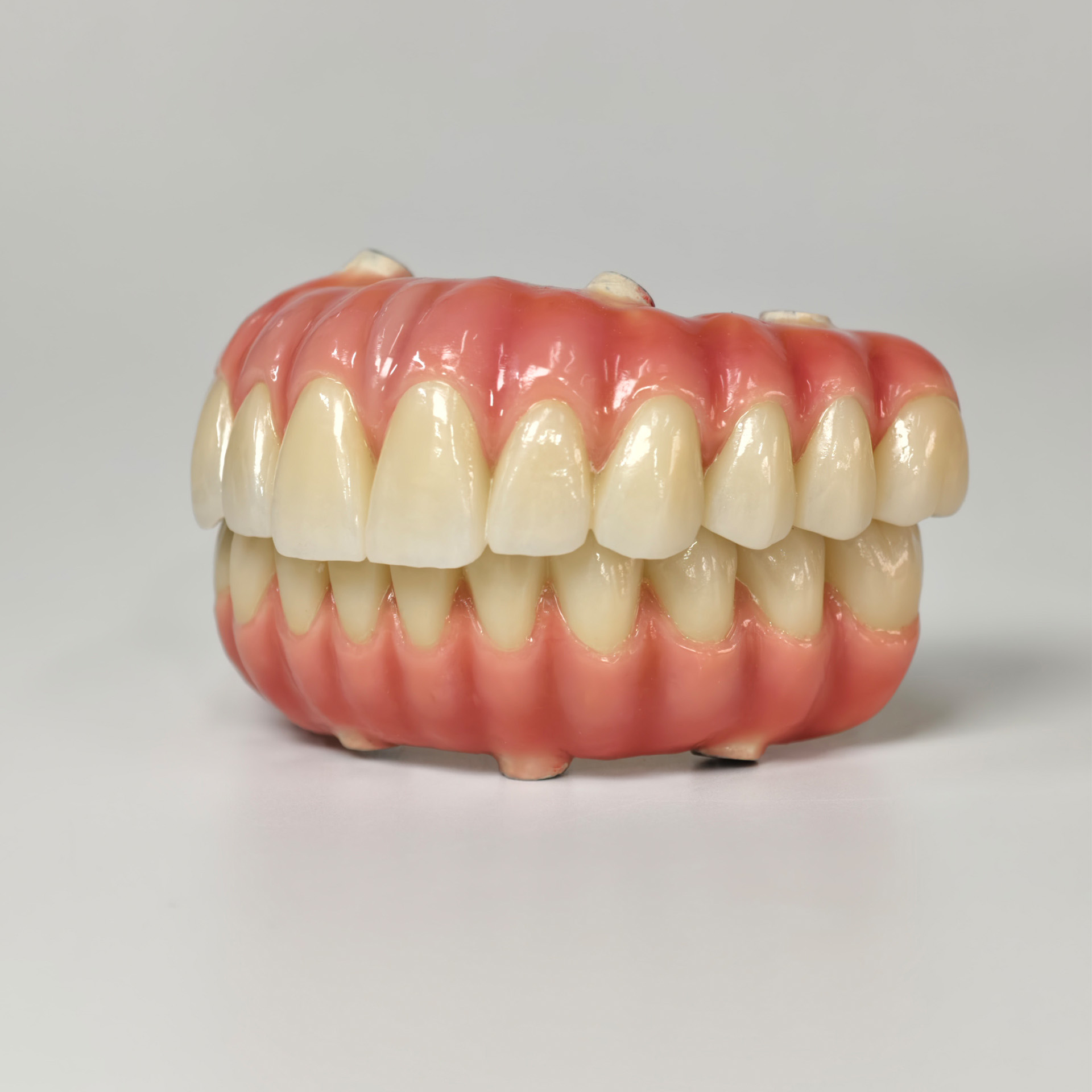 Zirconia-Enamel Hybrid Malo Bridge
