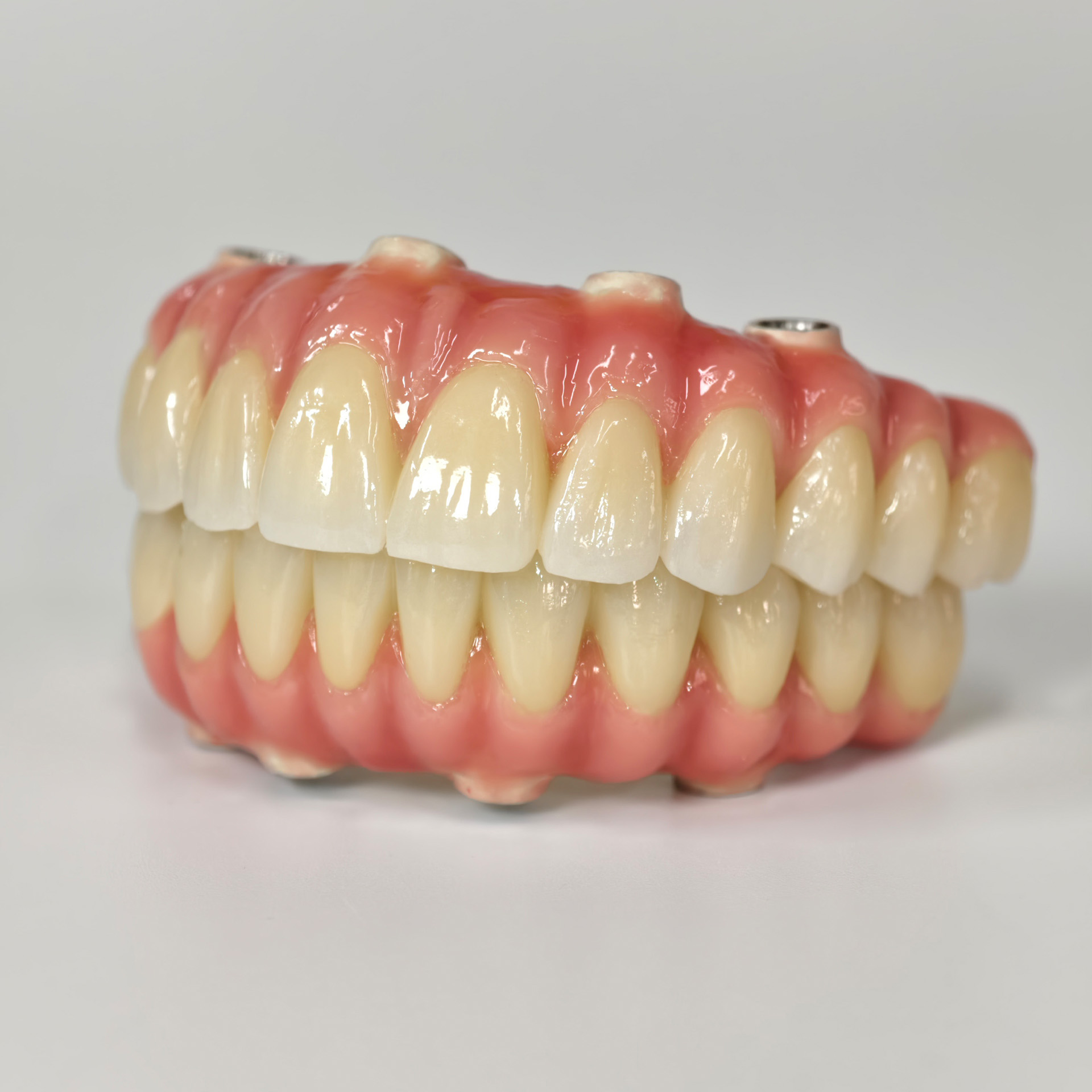 Zirconia-Enamel Hybrid Malo Bridge