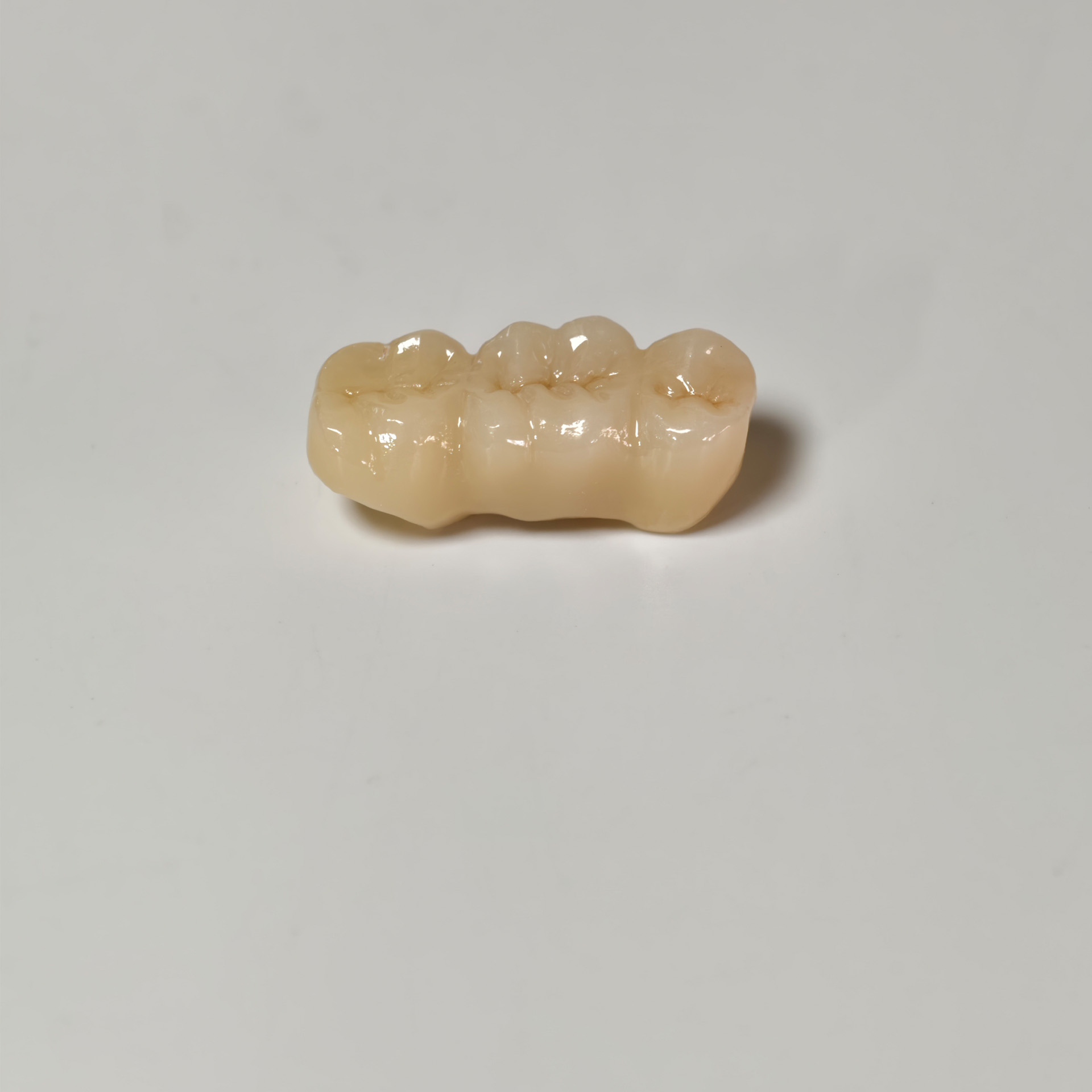 High - Strength Zirconia Bridge