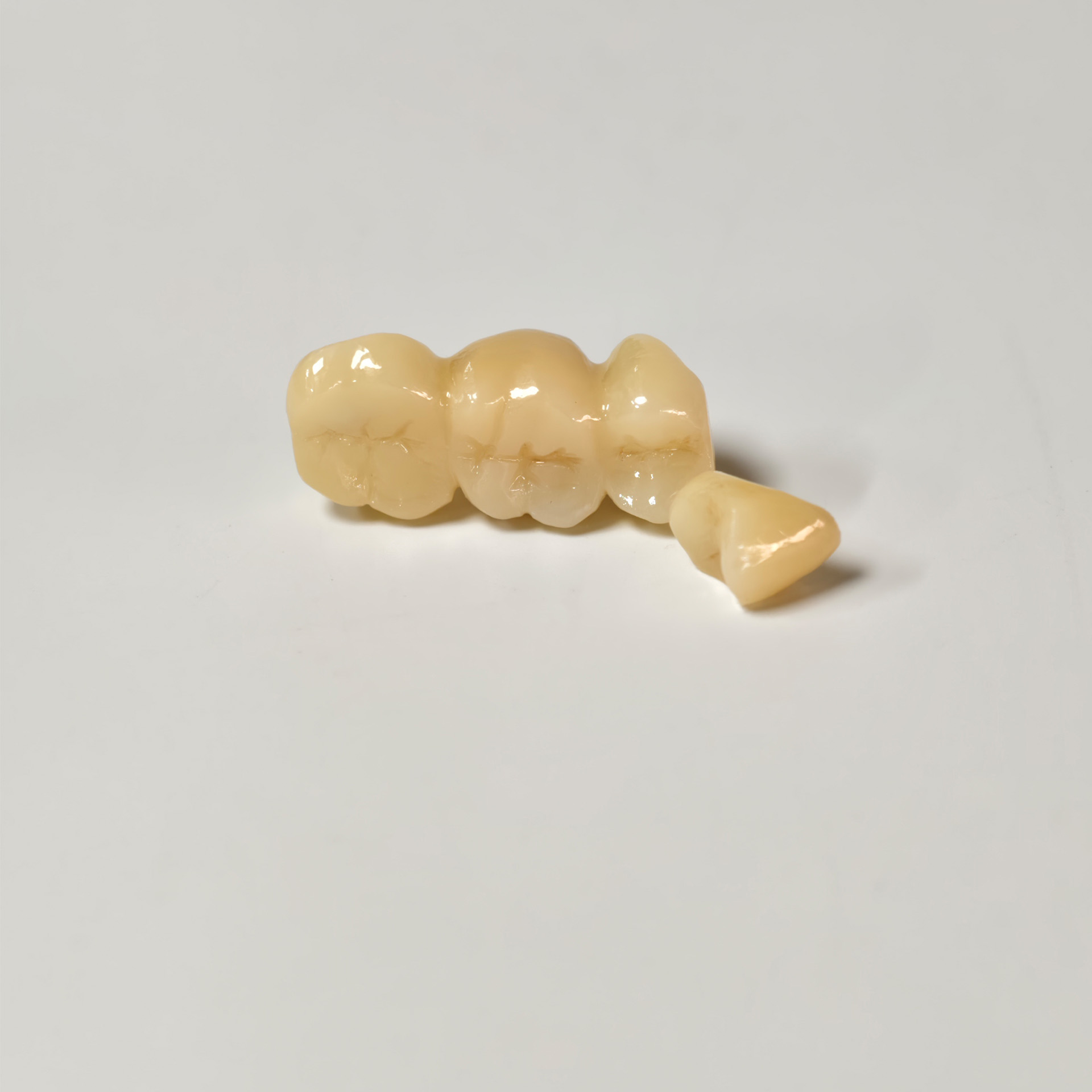 High - Strength Zirconia Bridge and Crow