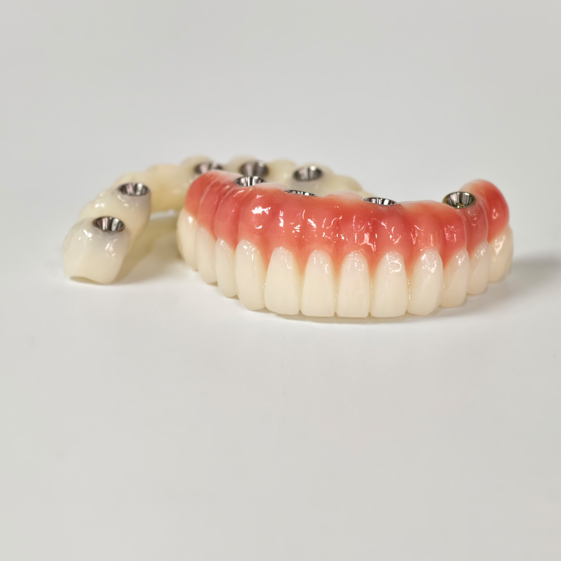 Full-arch PMMA bridge with ti-base screw