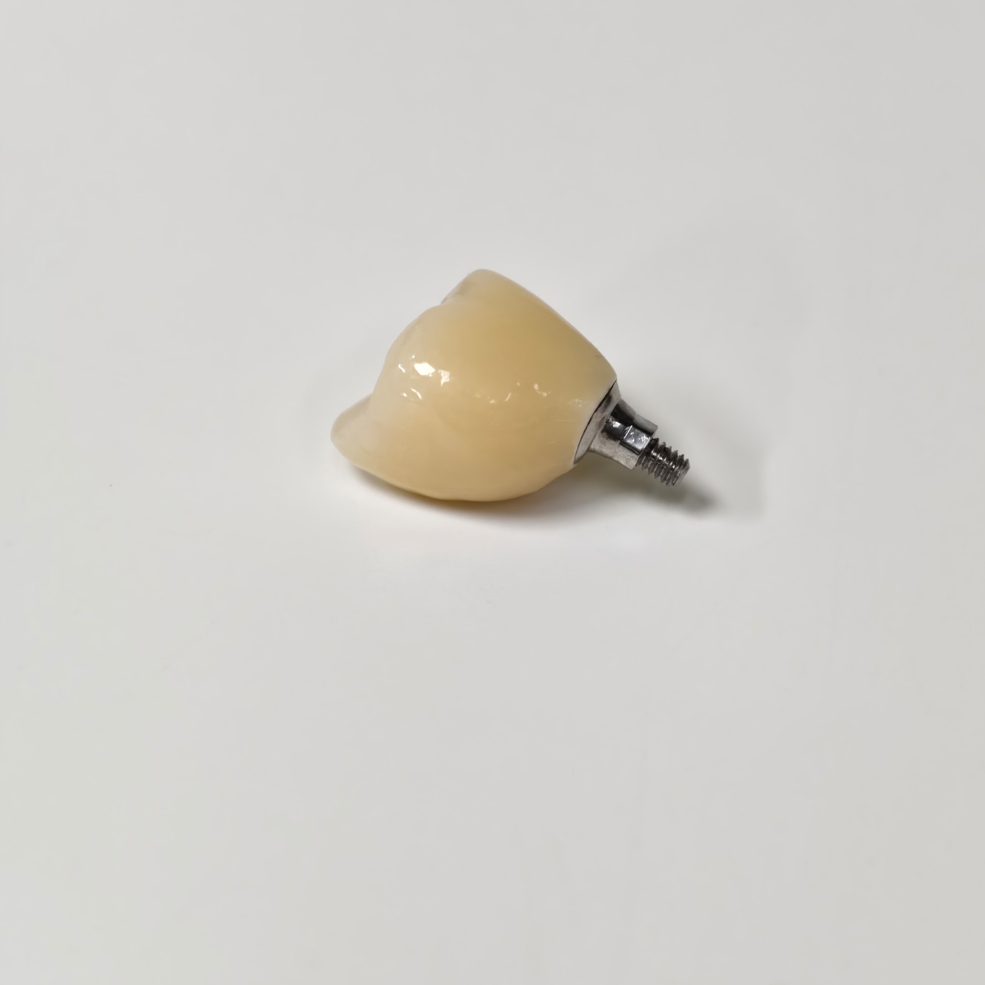 Zirconia crown with screw retained