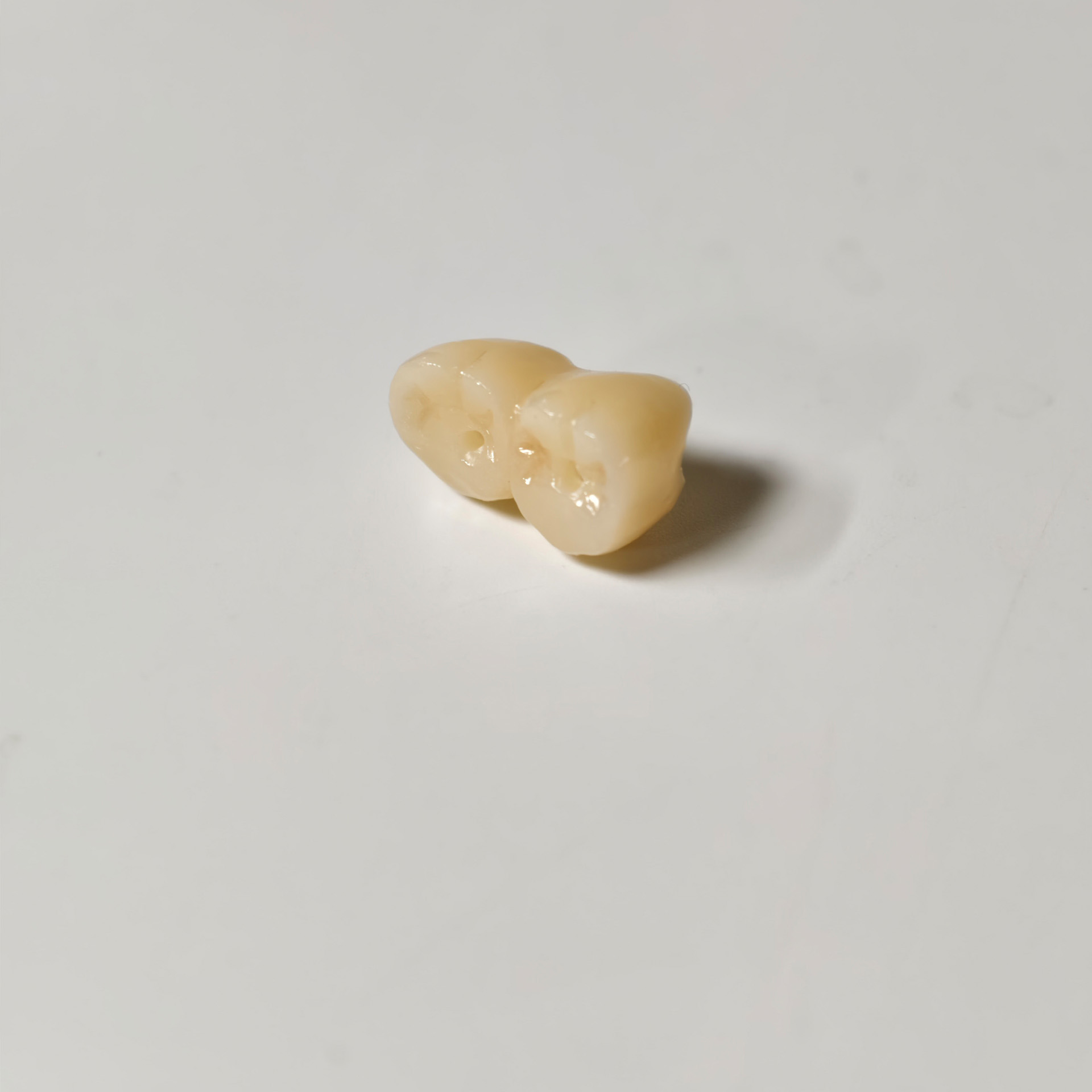 Zirconia implant bridge Screwmentable de