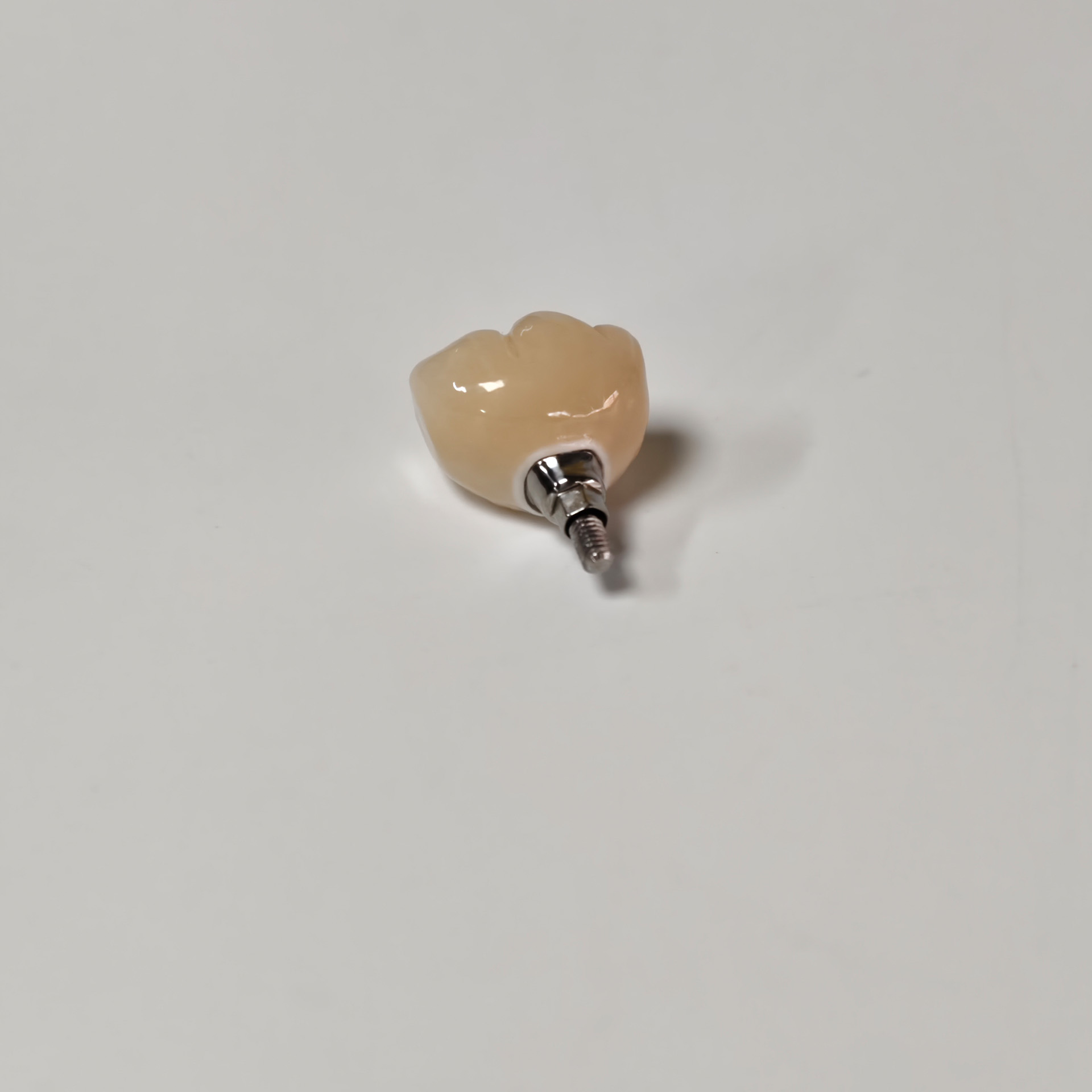 Zirconia crown with screw retained