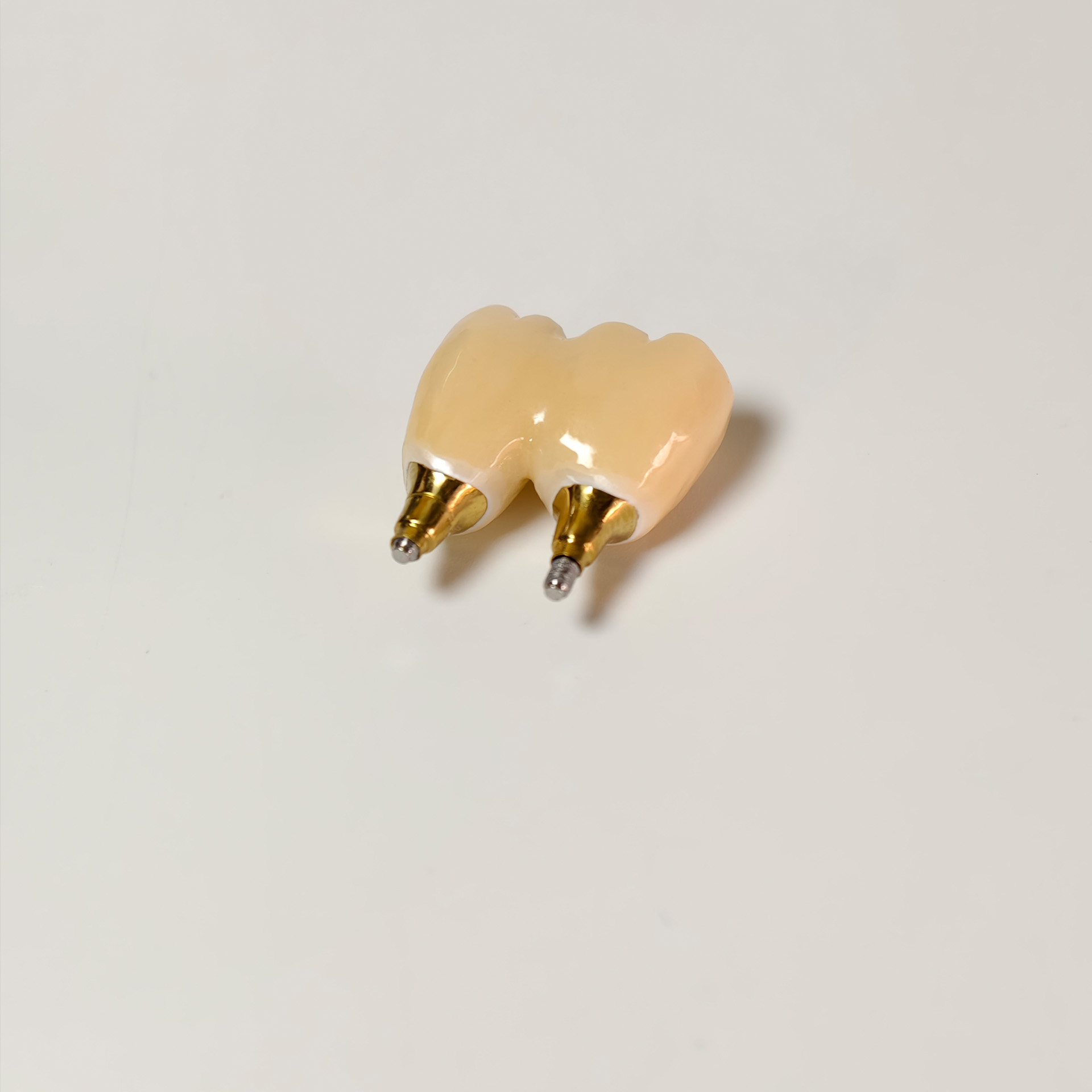 Zirconia Bridge with screw retained