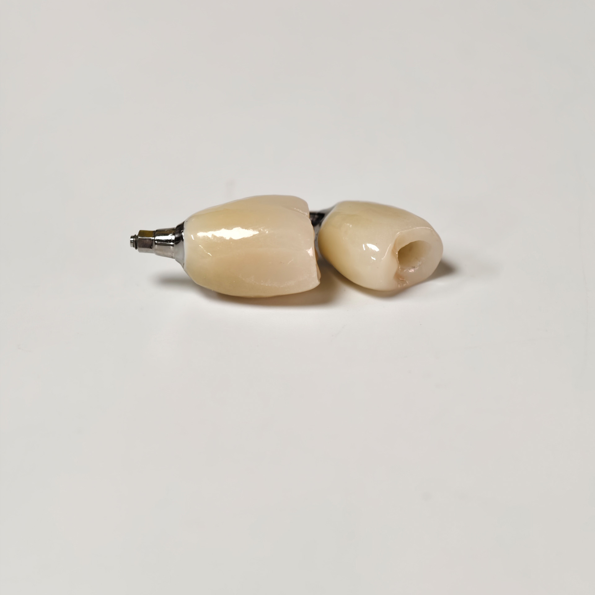 Zirconia crowns with screw retained