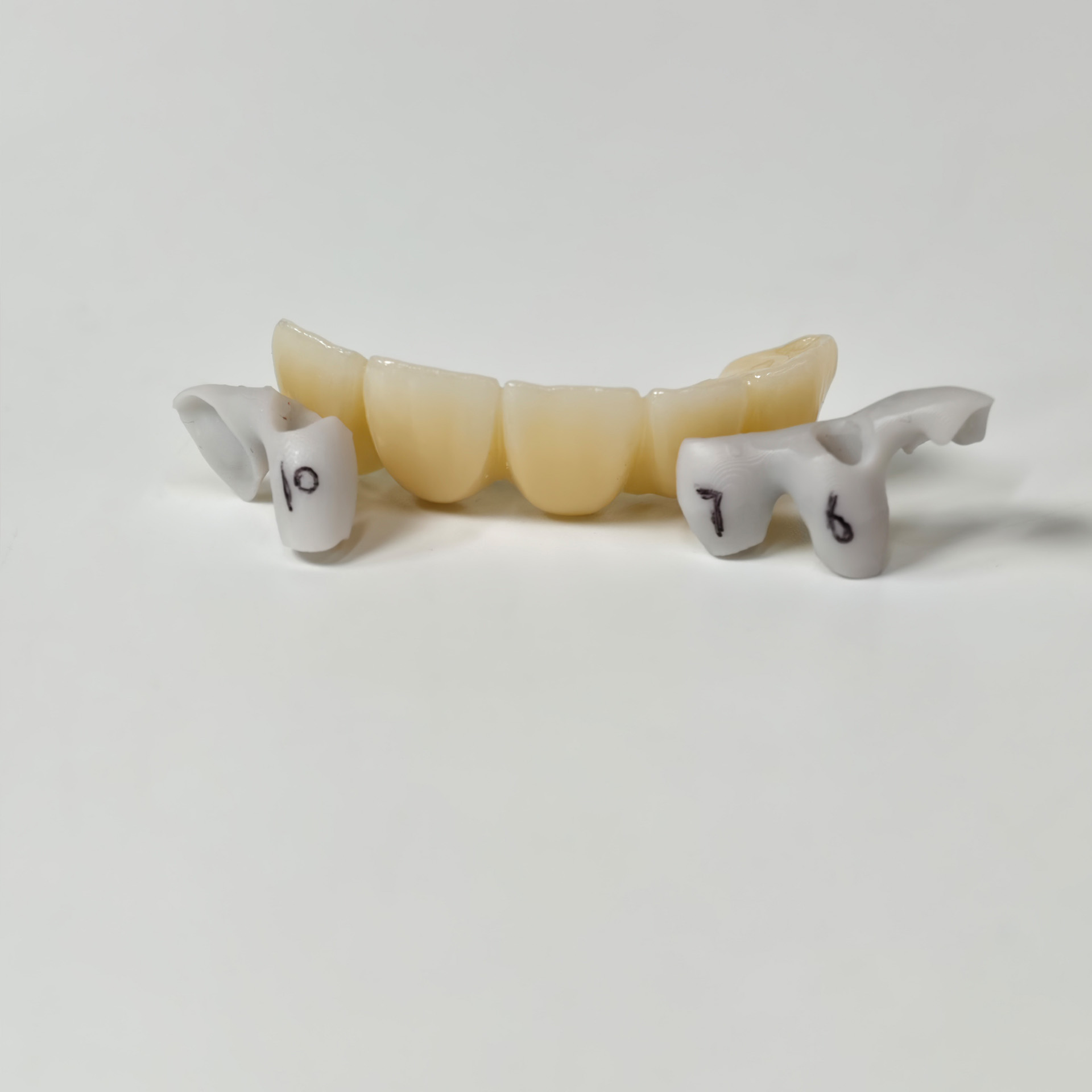 Zirconia implant bridge Screwmentable de