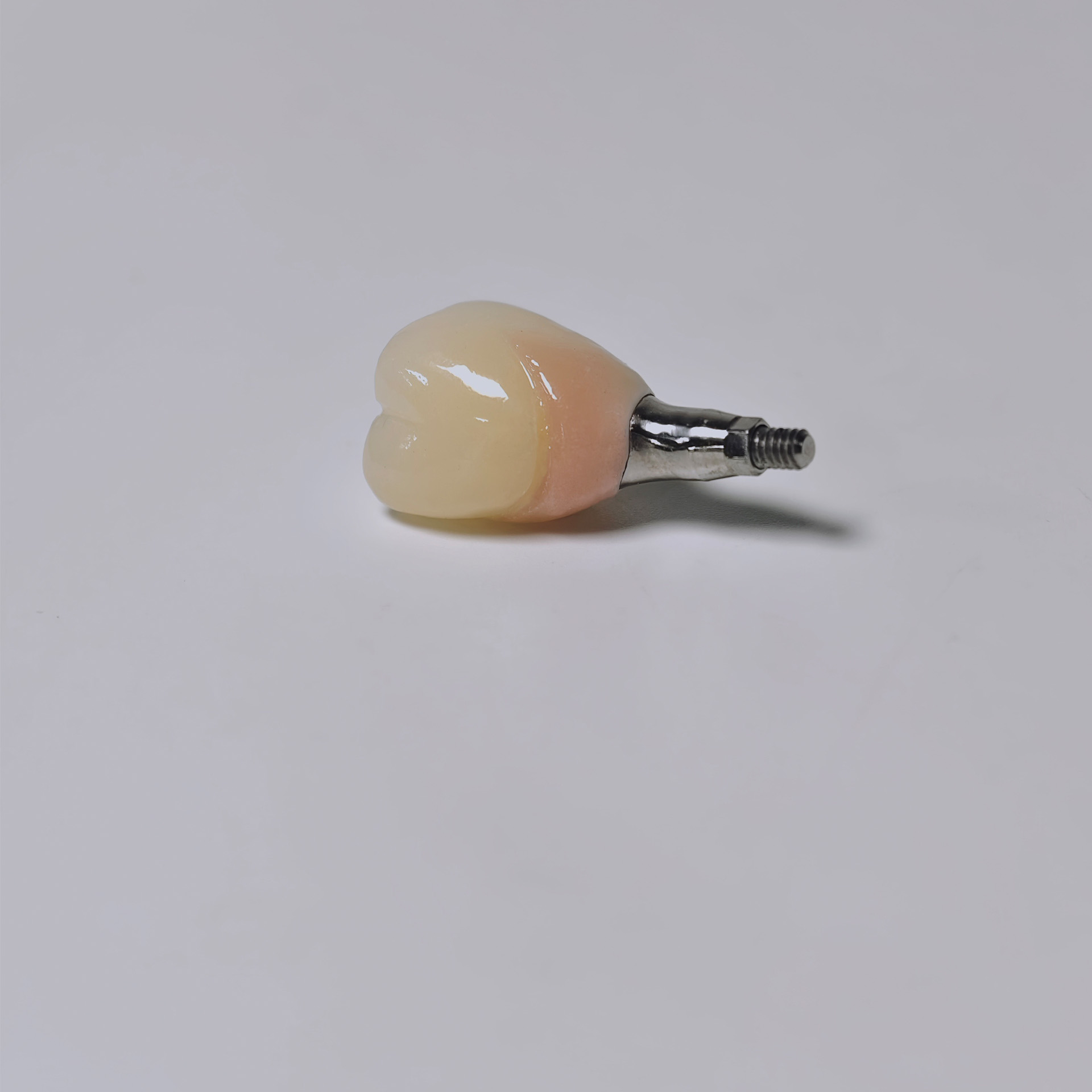 Zirconia crown with screw retained