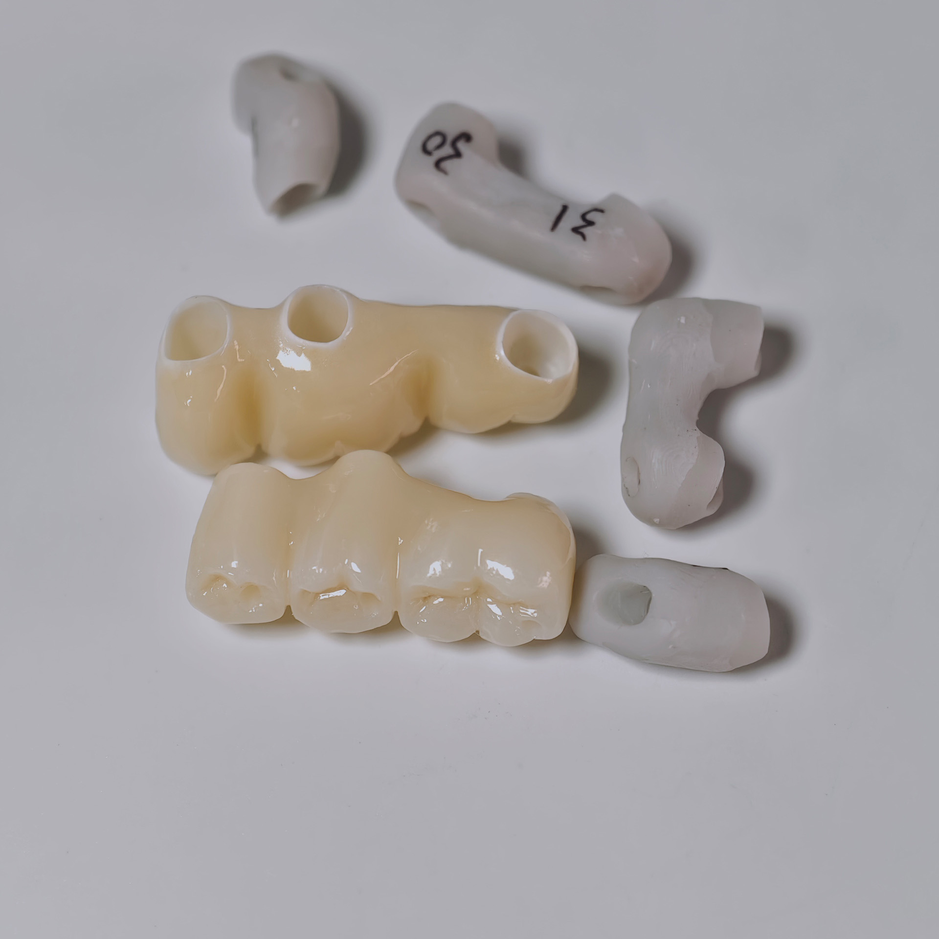 Zirconia implant bridges Screwmentable d