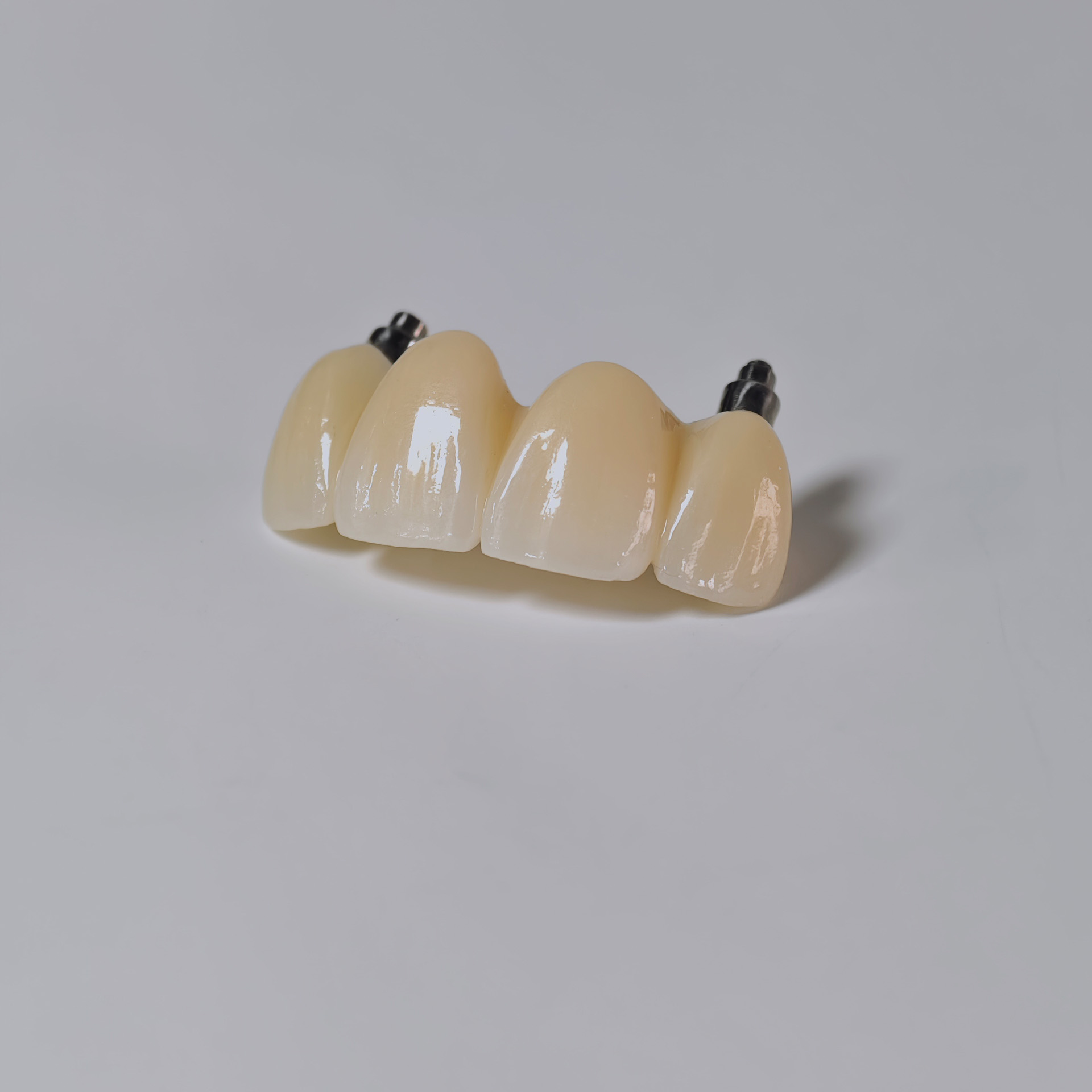 Zirconia bridge with screw retained