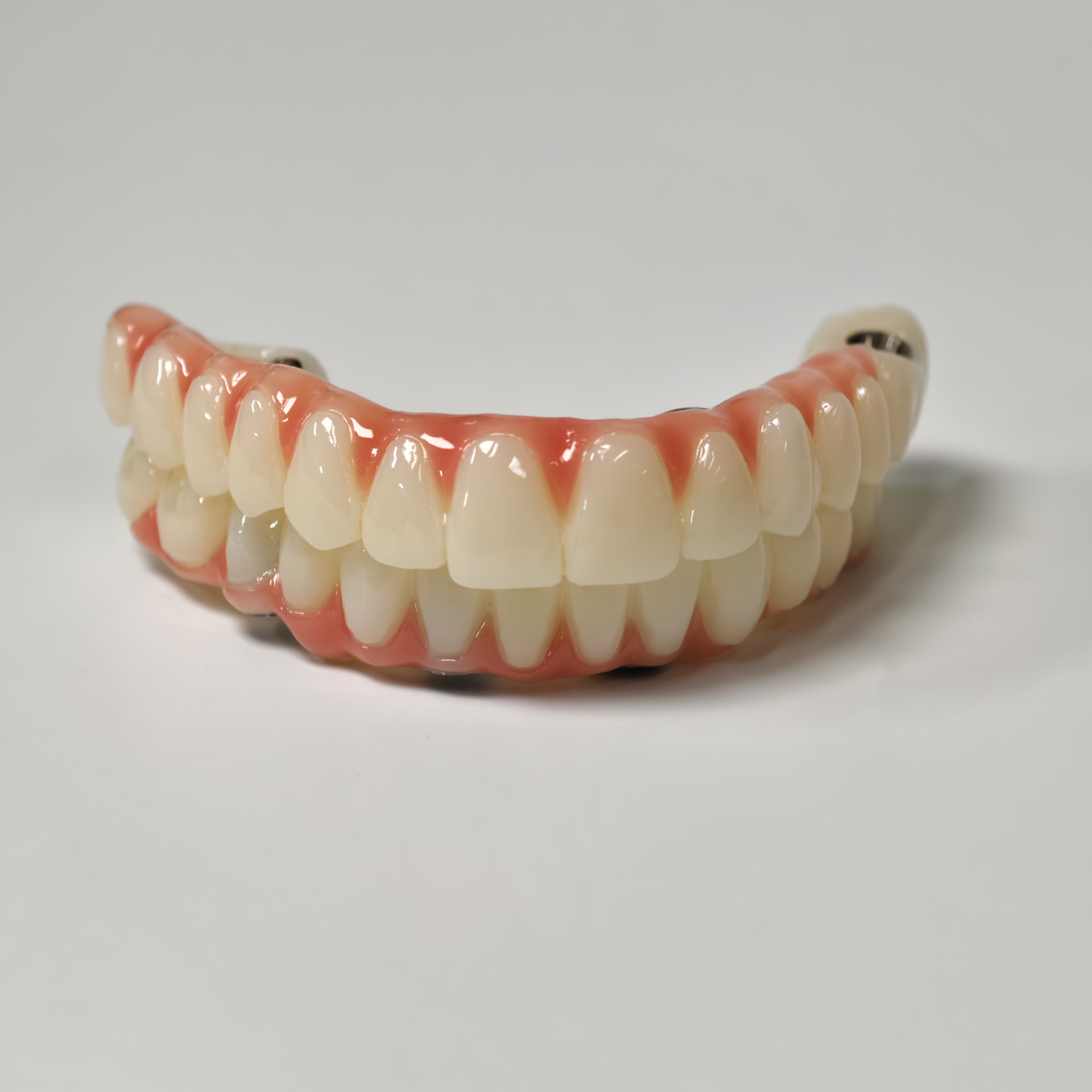 Full-arch PMMA bridge with ti-base screw