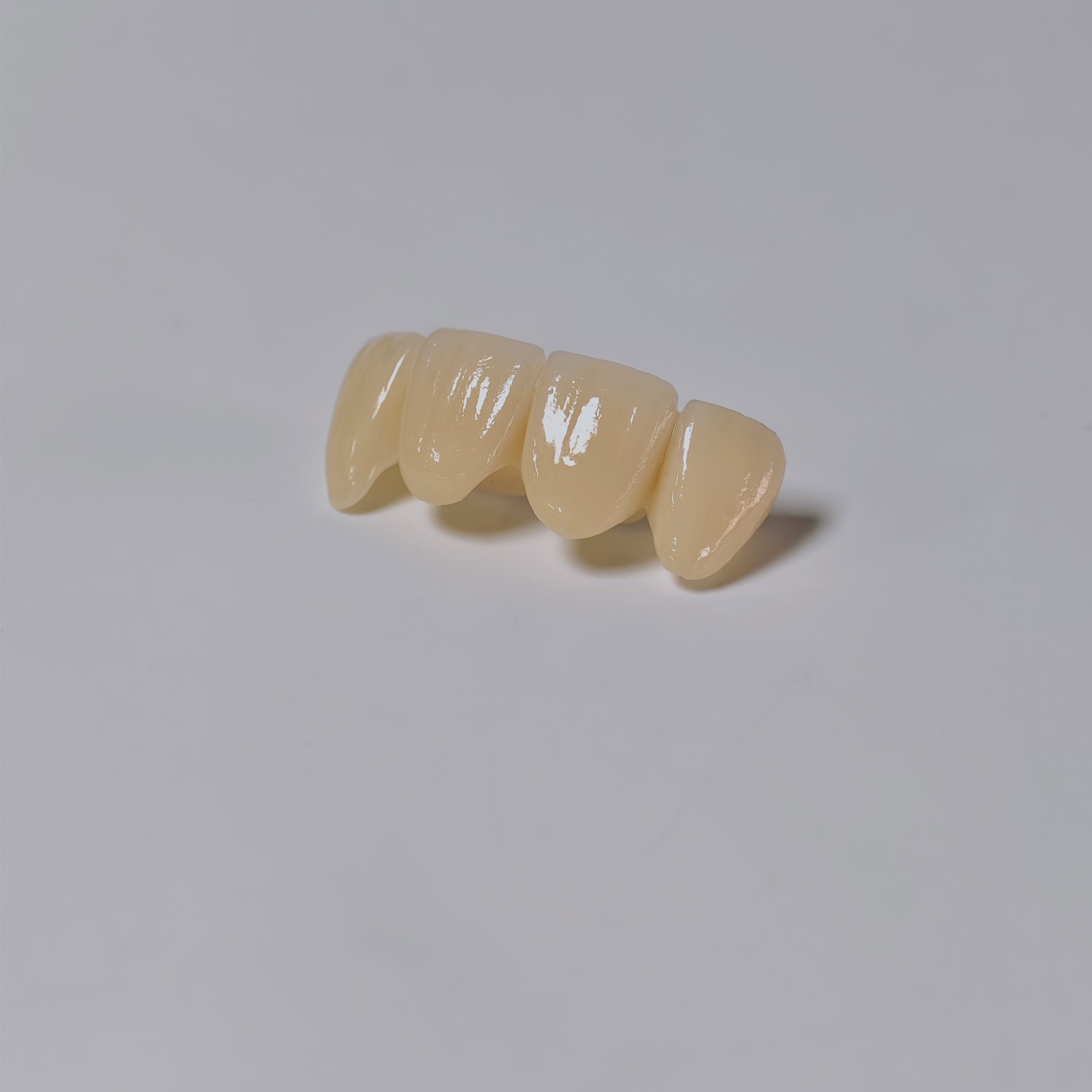 High - Strength Zirconia Bridge
