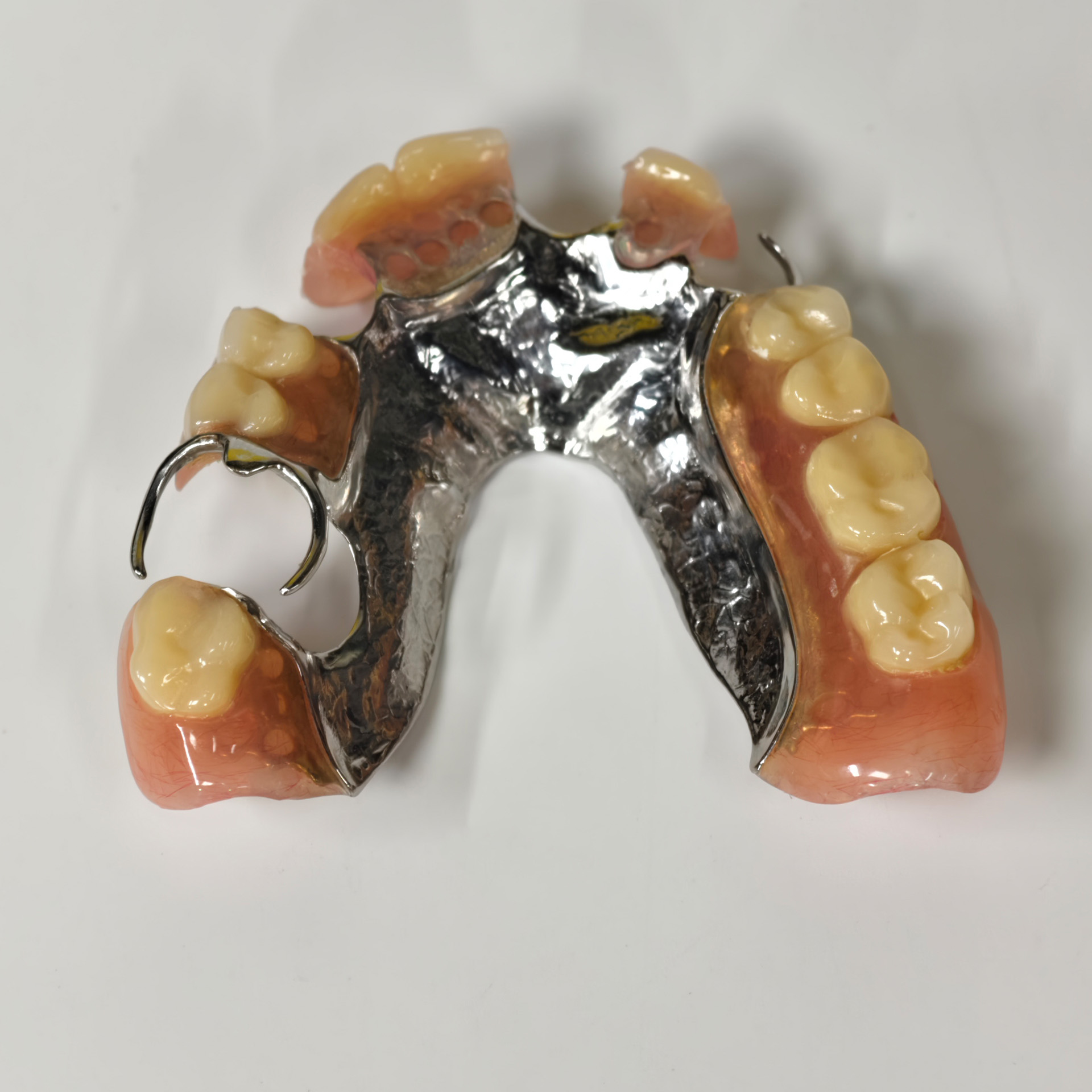 Cobalt chrome framework dentur