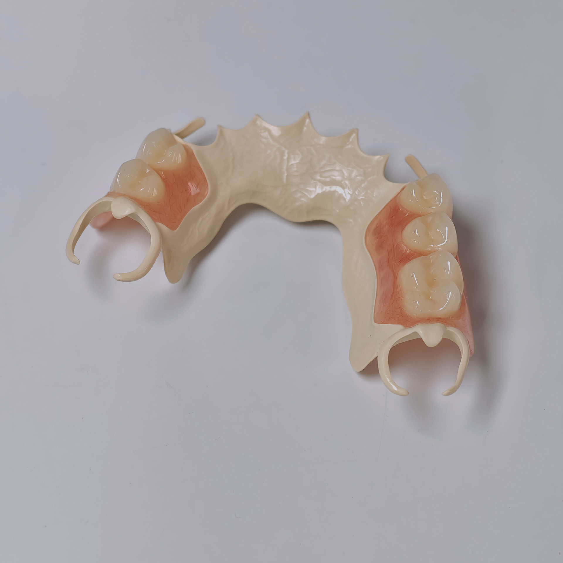 PEEK framework denture Metal f