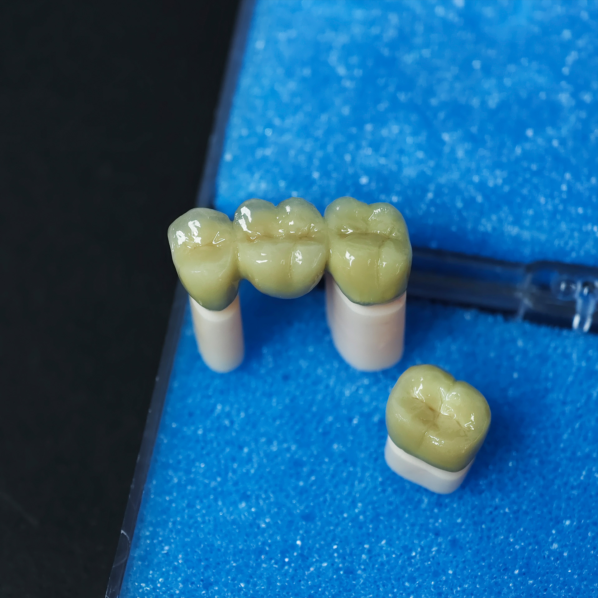 Co - Cr PFM Dental Crowns and bridge